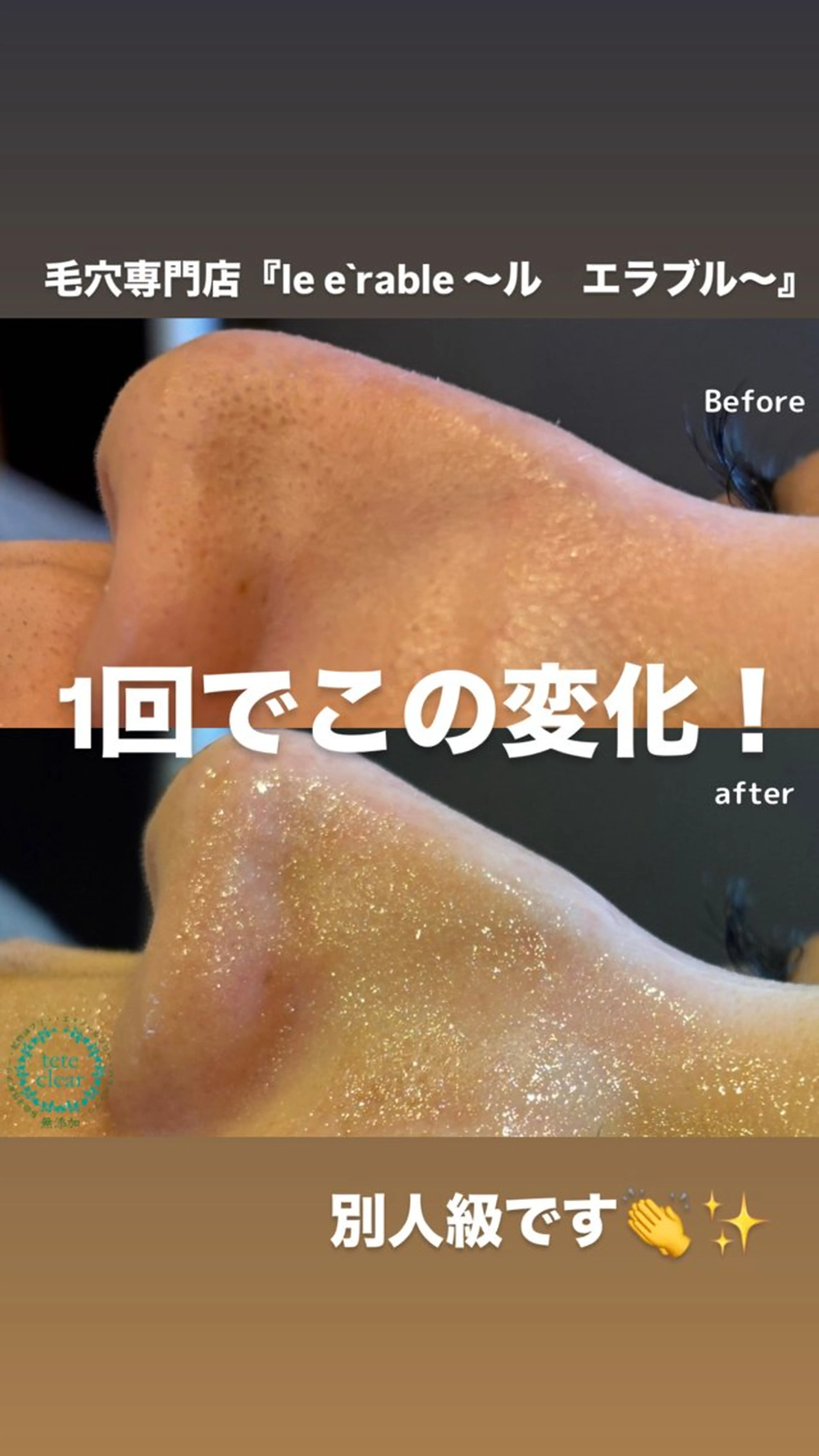 スペシャル陶器肌コースの写真