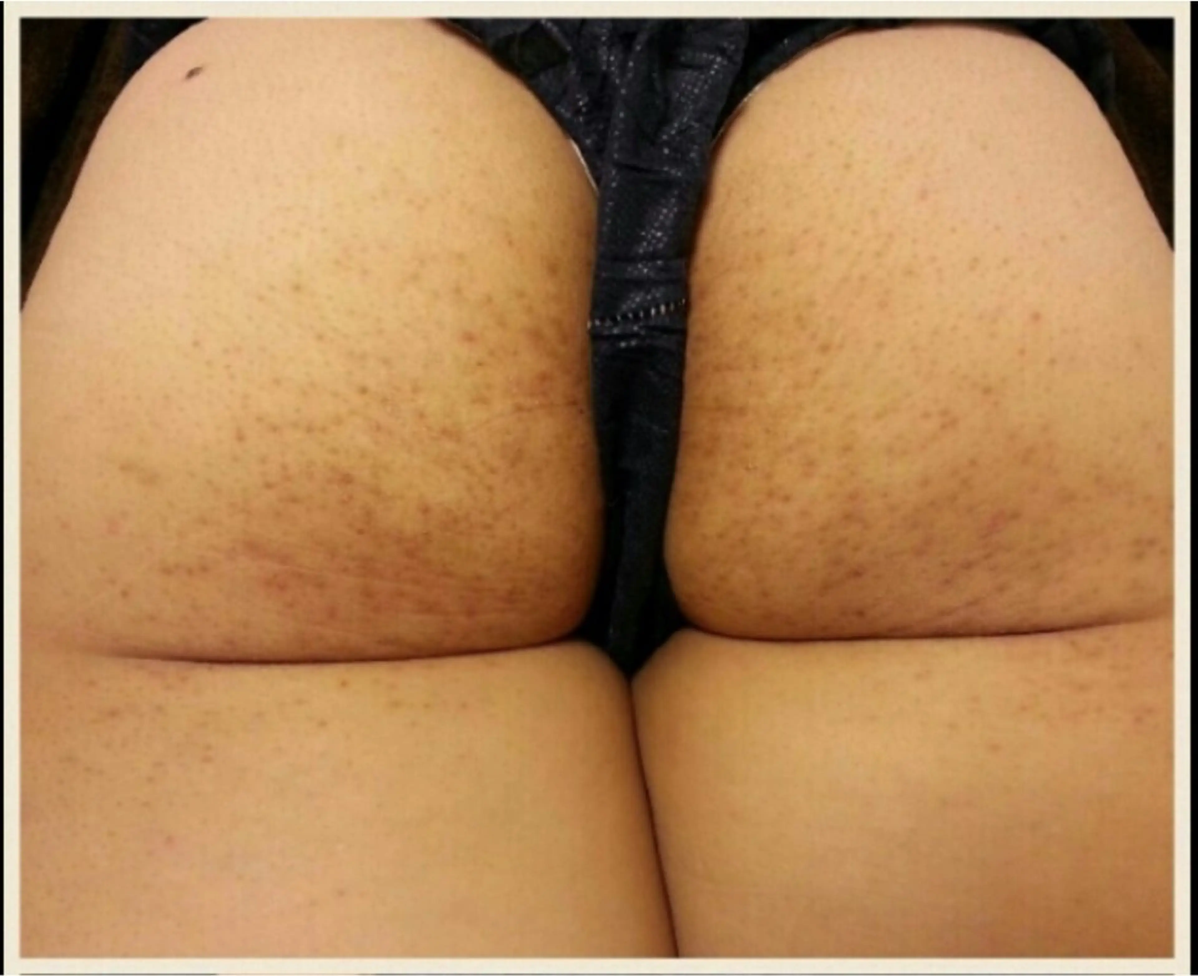 ピーリングサロン シャンテール所属・ピーリングサロン シャンテールのエステ・リラクイメージ