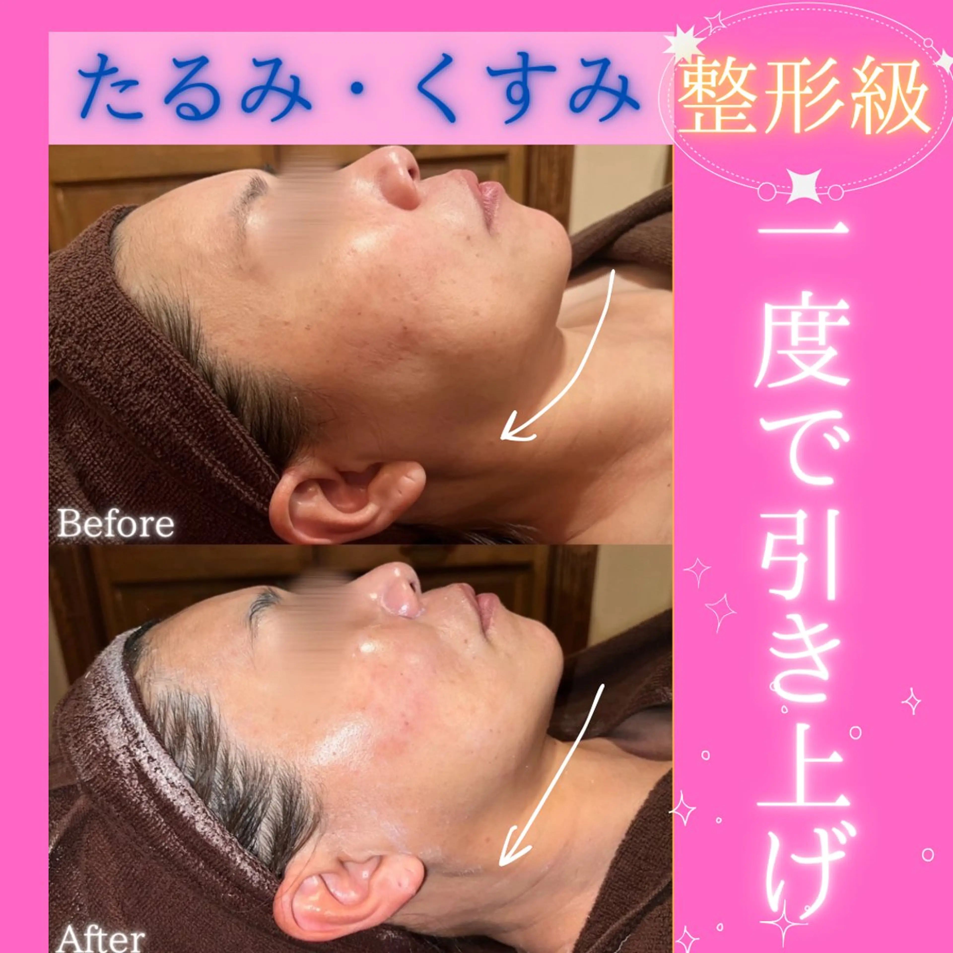 エステ 痩身&美肌サロン 堀米✨のエステ・リラクイメージ