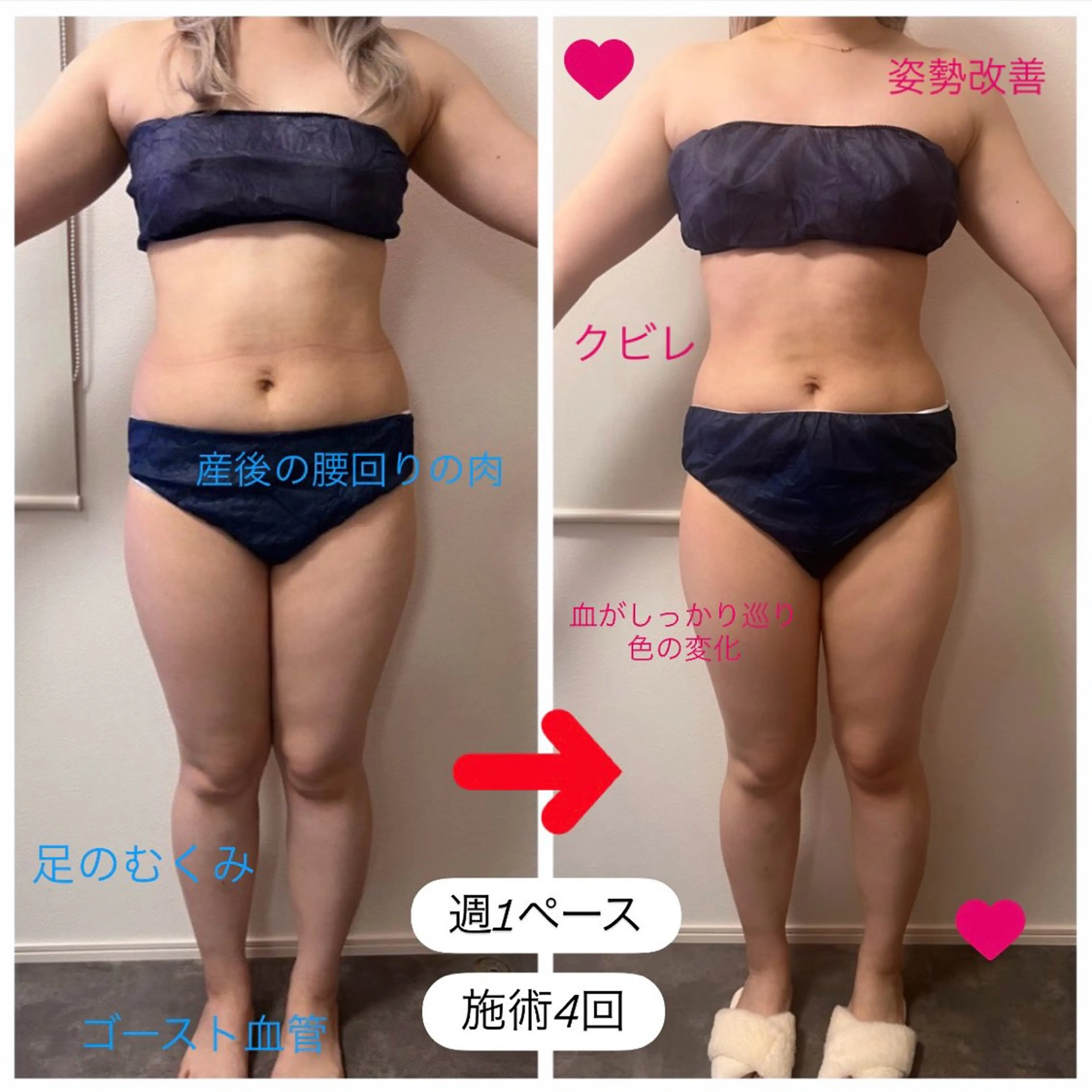 エステ 本気で痩せたい方へ 痩身専門サロンのその他イメージ