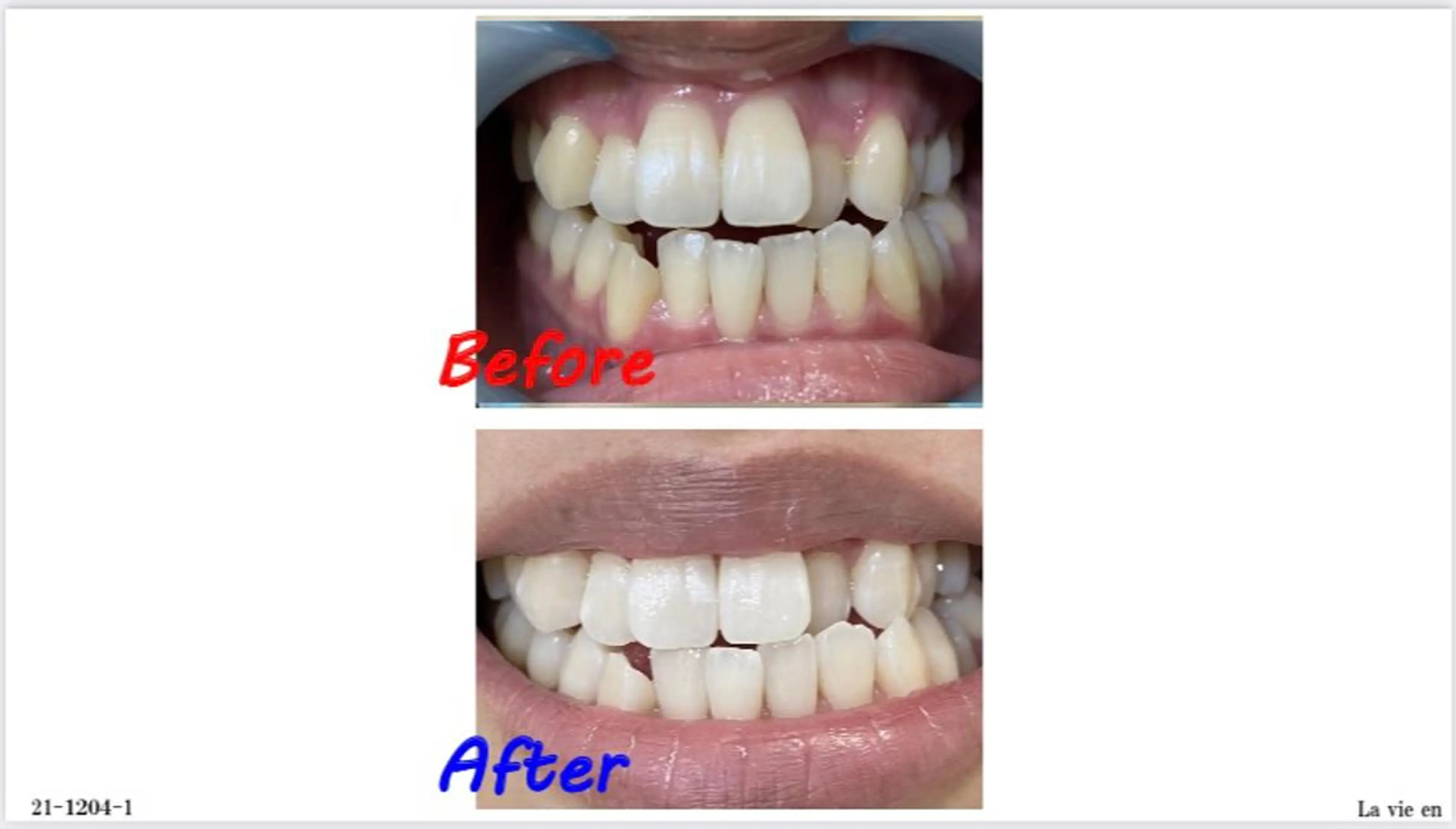 その他 セルフホワイトニングサロン　ラヴィアン所属・ホワイトニングサロン La vie enのその他イメージ