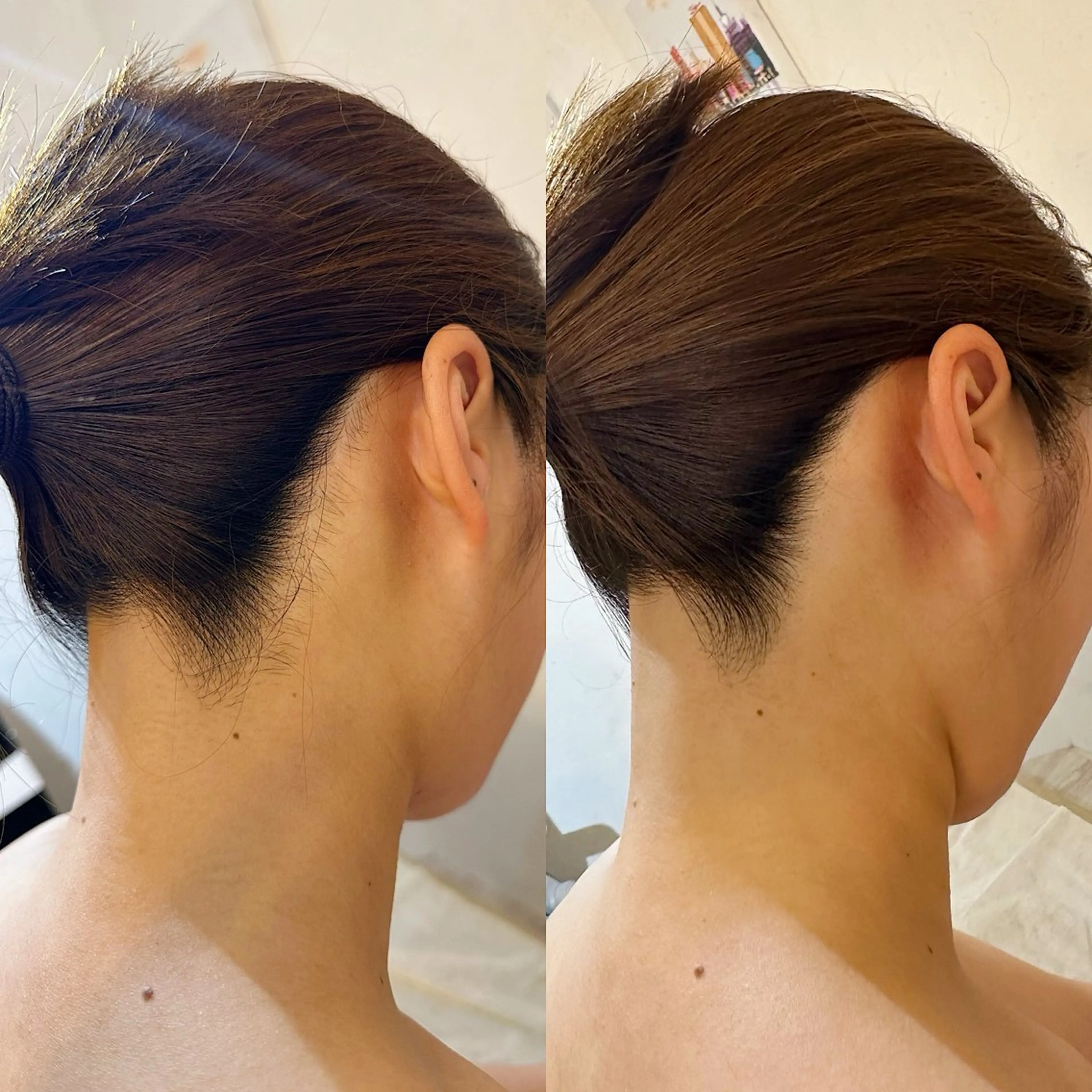 脱毛 うなじ脱毛/美肌脱毛 LABELのエステ・リラクイメージ