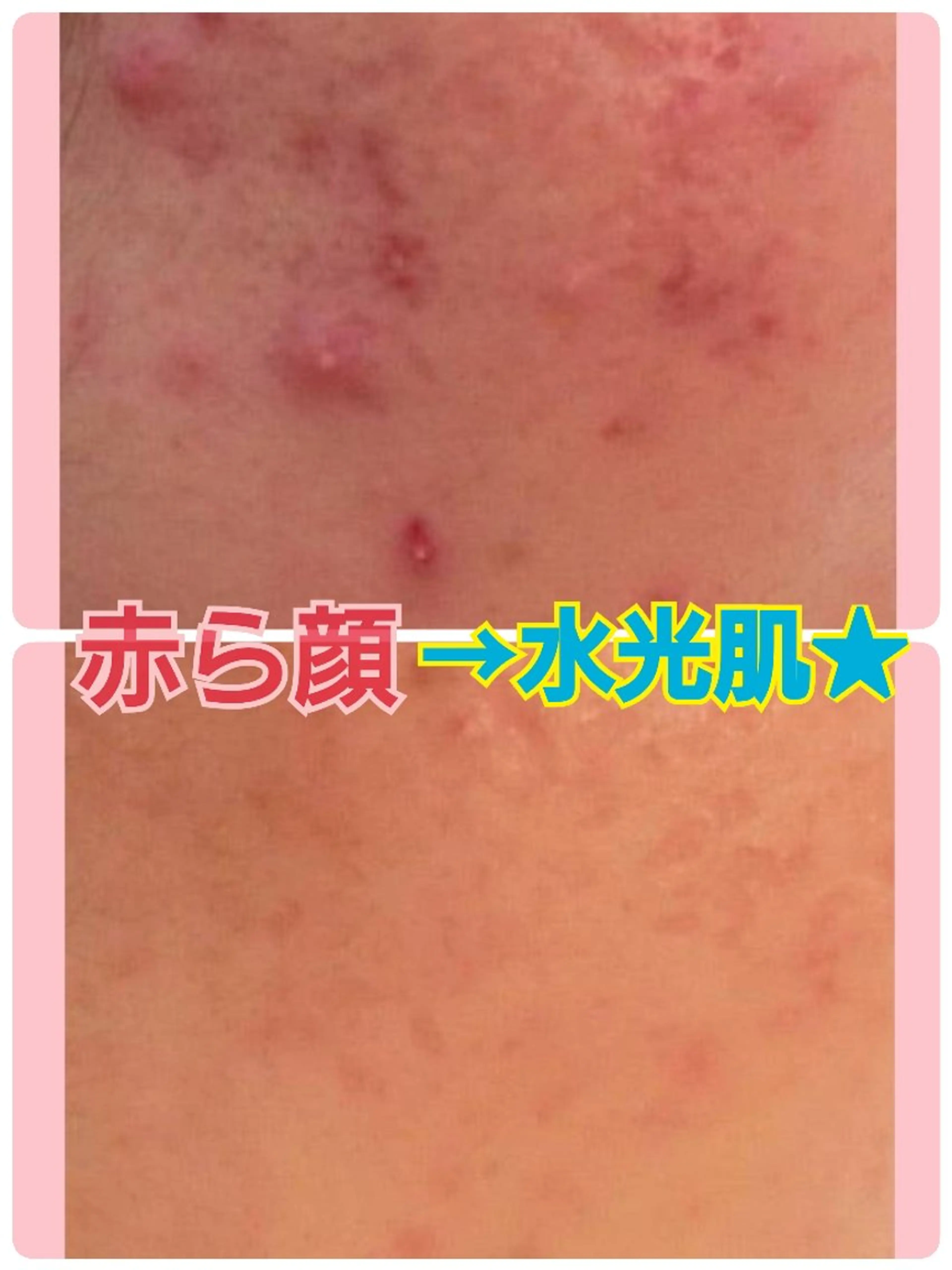 エステ ハーブピーリング 専門店Kikkaのエステ・リラクイメージ