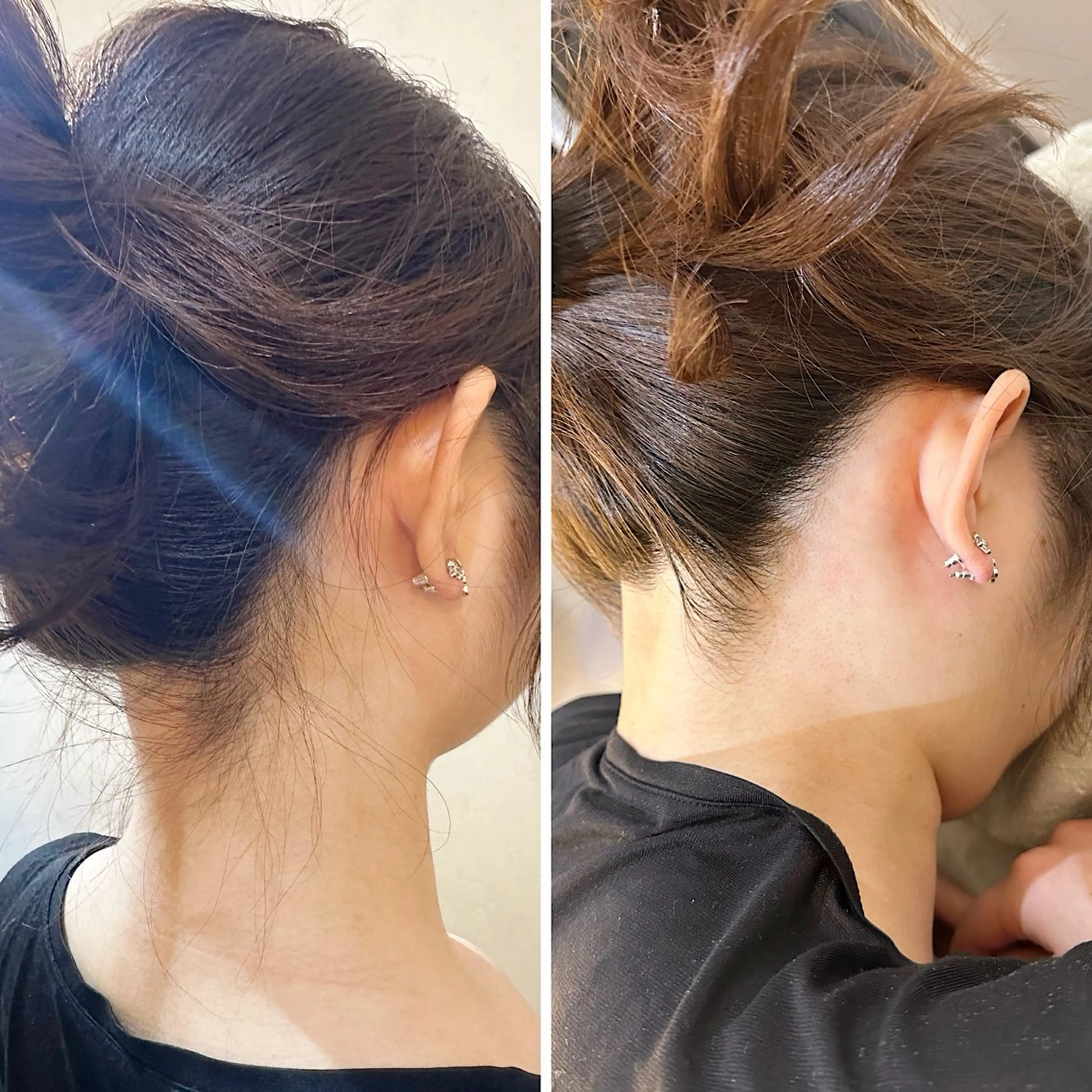 うなじ脱毛/美肌脱毛 LABELのエステ・リラクイメージ