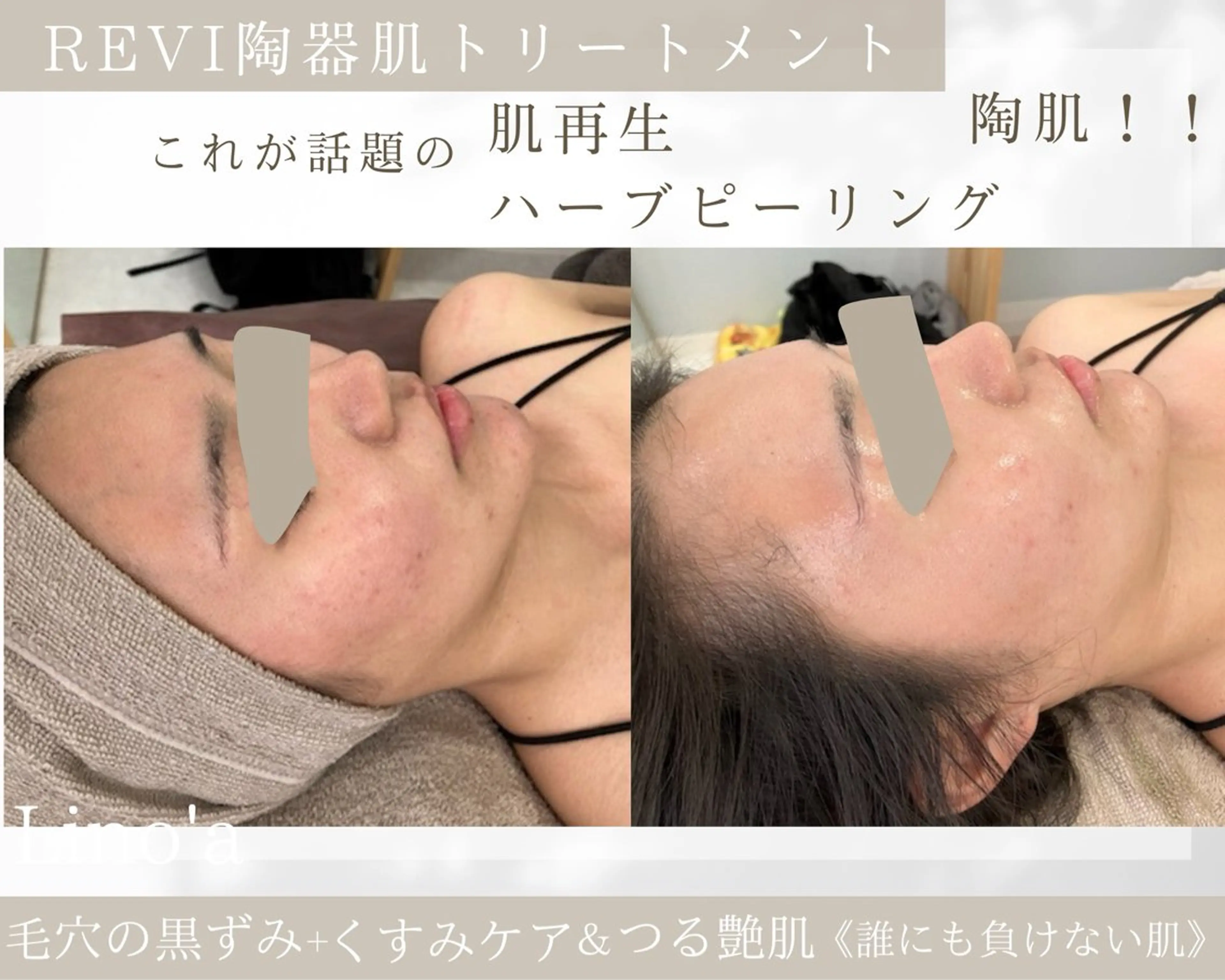 エステ リラク Salon💫 Lino'a柏店のエステ・リラクイメージ