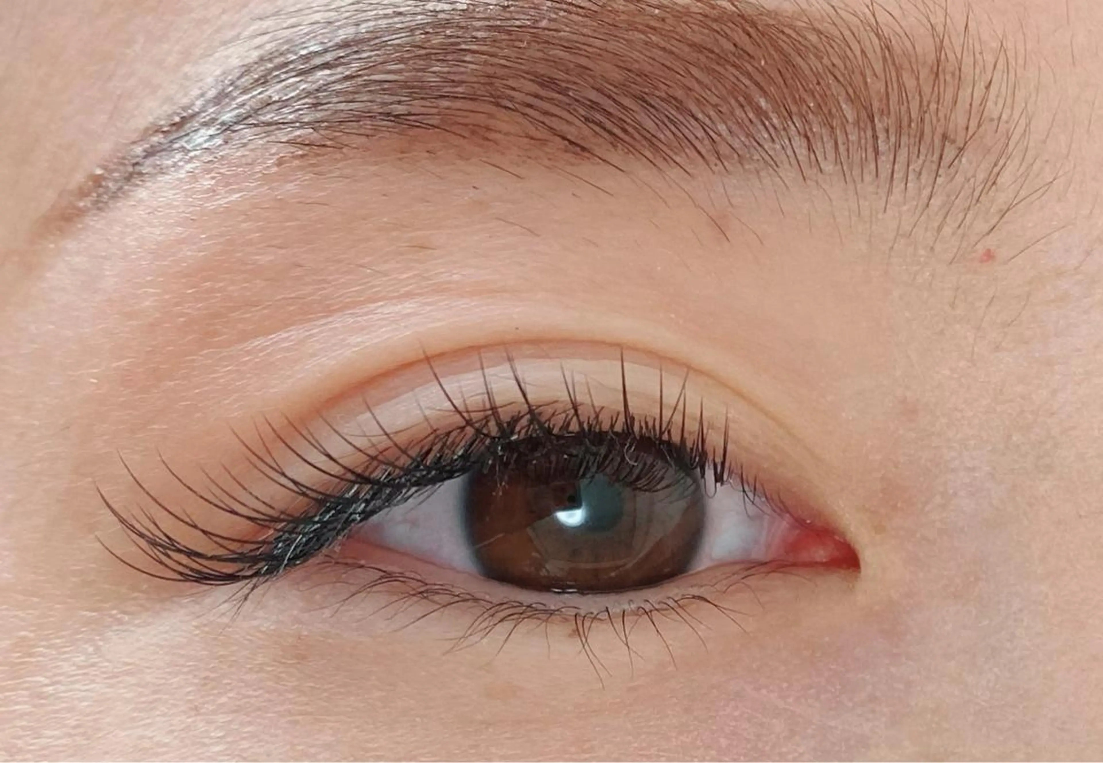 フラットラッシュ100本の写真