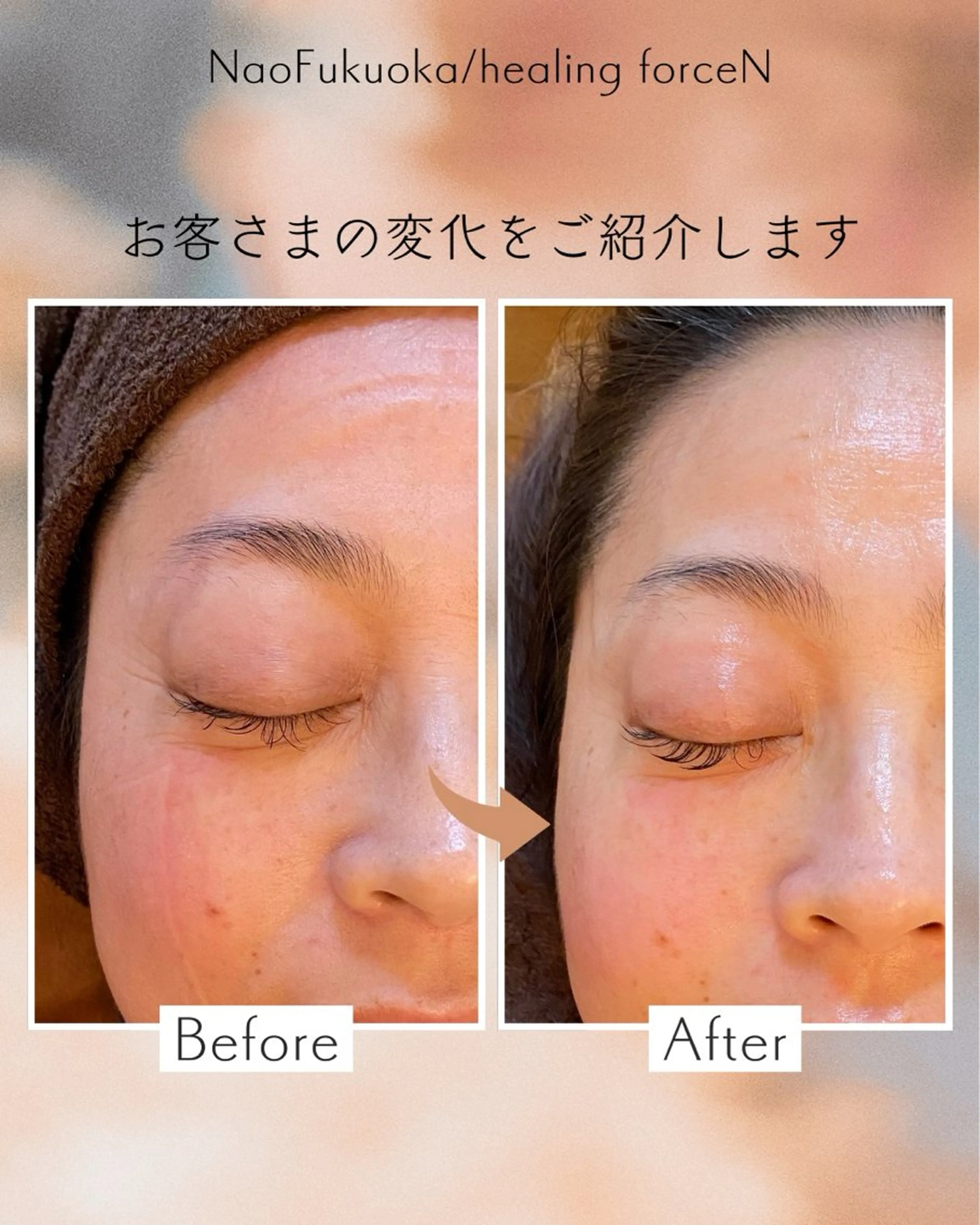 Nao Fukuoka/healingforceN所属・野中 康子のエステ・リラクイメージ