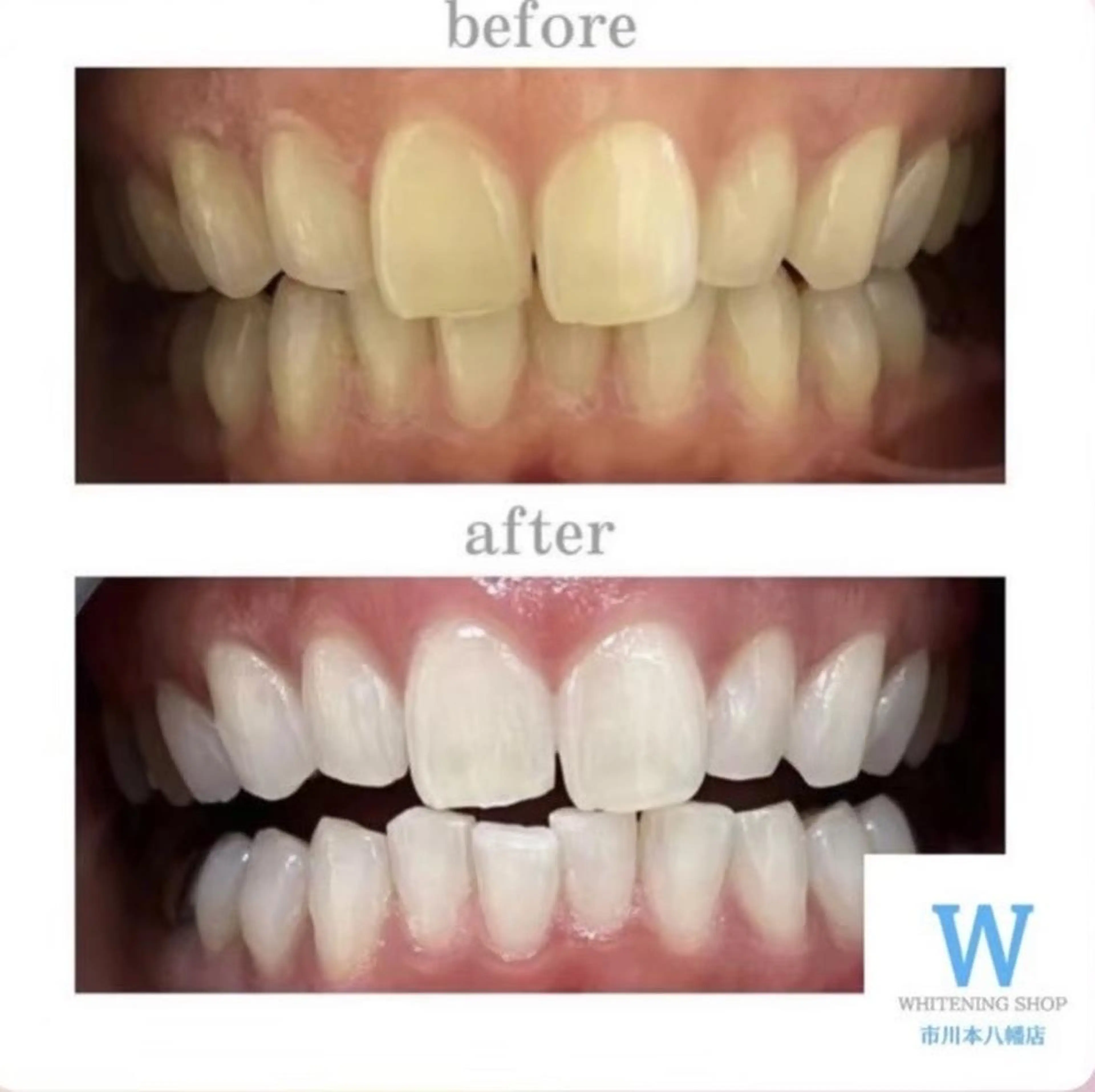 エステ リラク ホワイトニング ショップ本八幡店のエステ・リラクイメージ