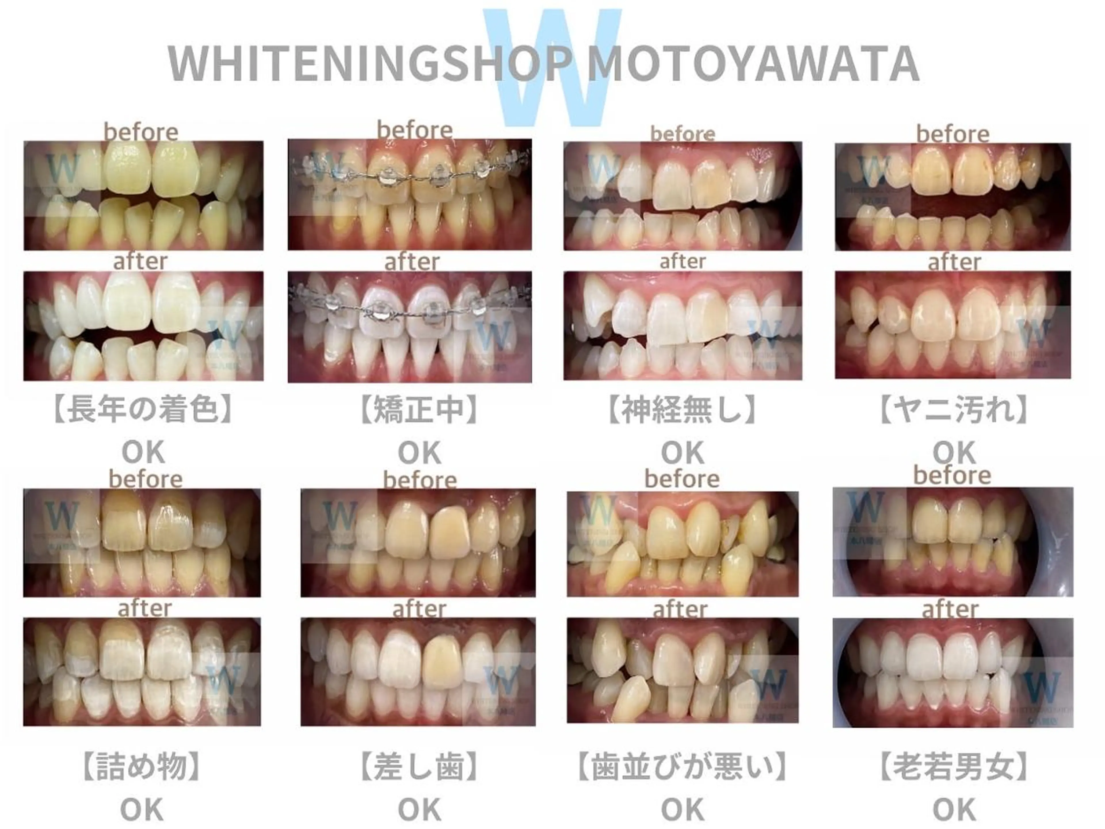 メンズ ホワイトニング ショップ本八幡店のエステ・リラクイメージ
