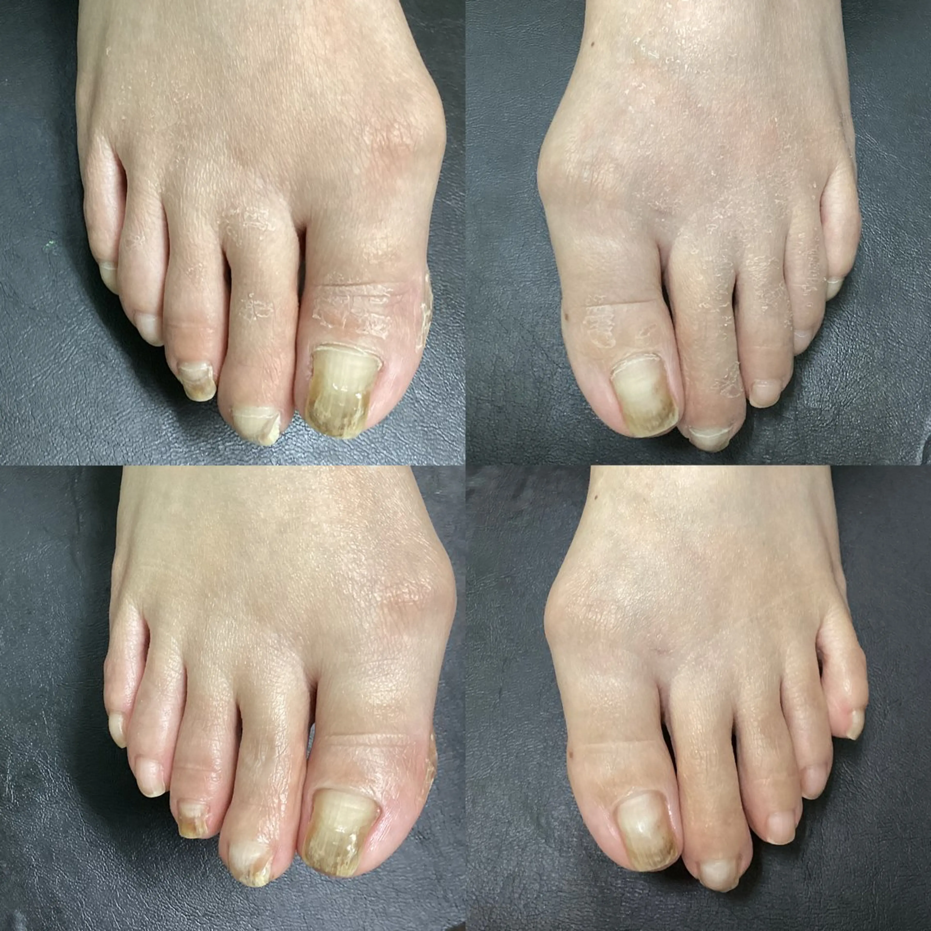 ネイル フットネイル ヒューマン 鍼灸接骨院所属・リラク/ヘッドスパ/ 足裏ケア/蛭川栞のエステ・リラクイメージ