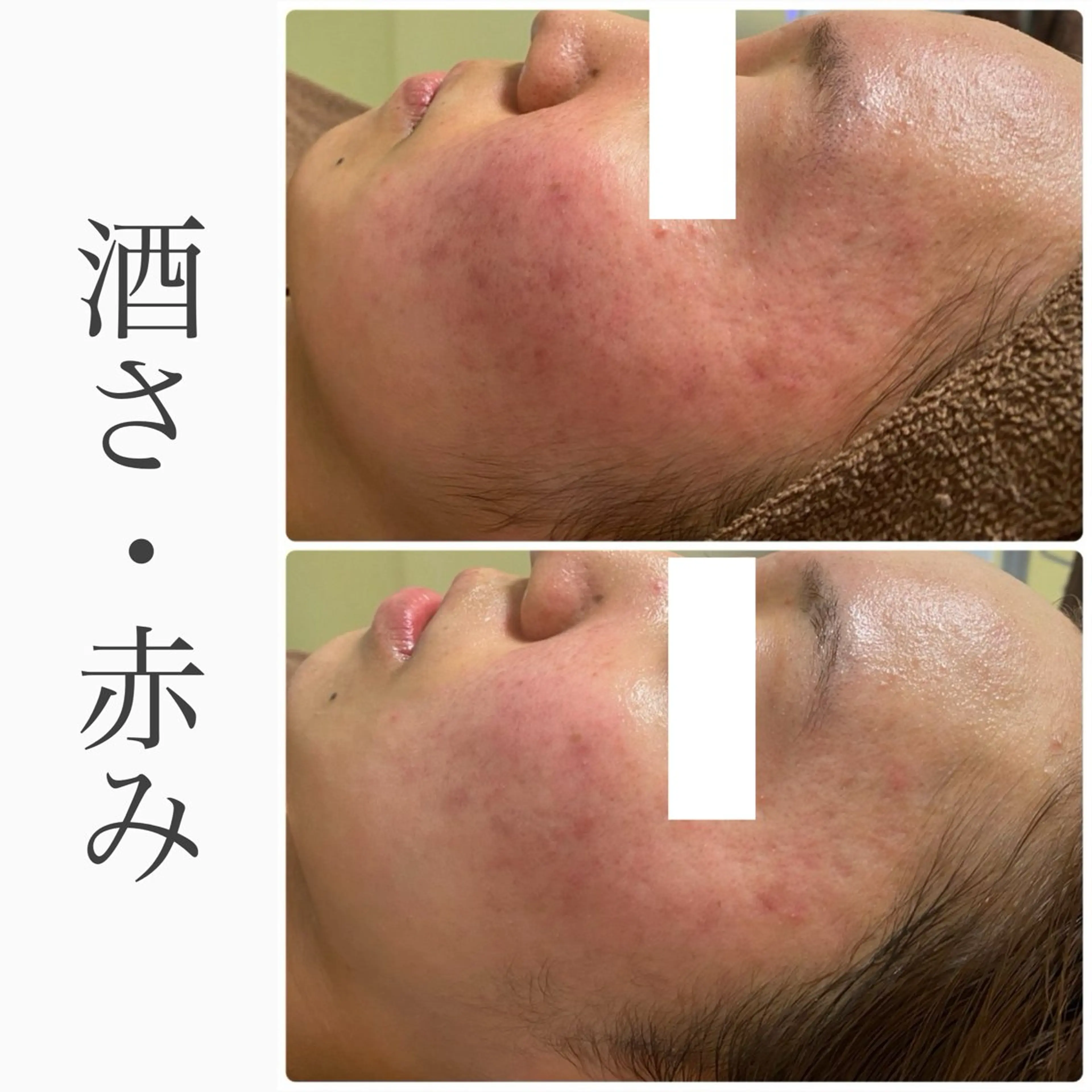 ハーブピーリング専門 BIOEL横浜のエステ・リラクイメージ