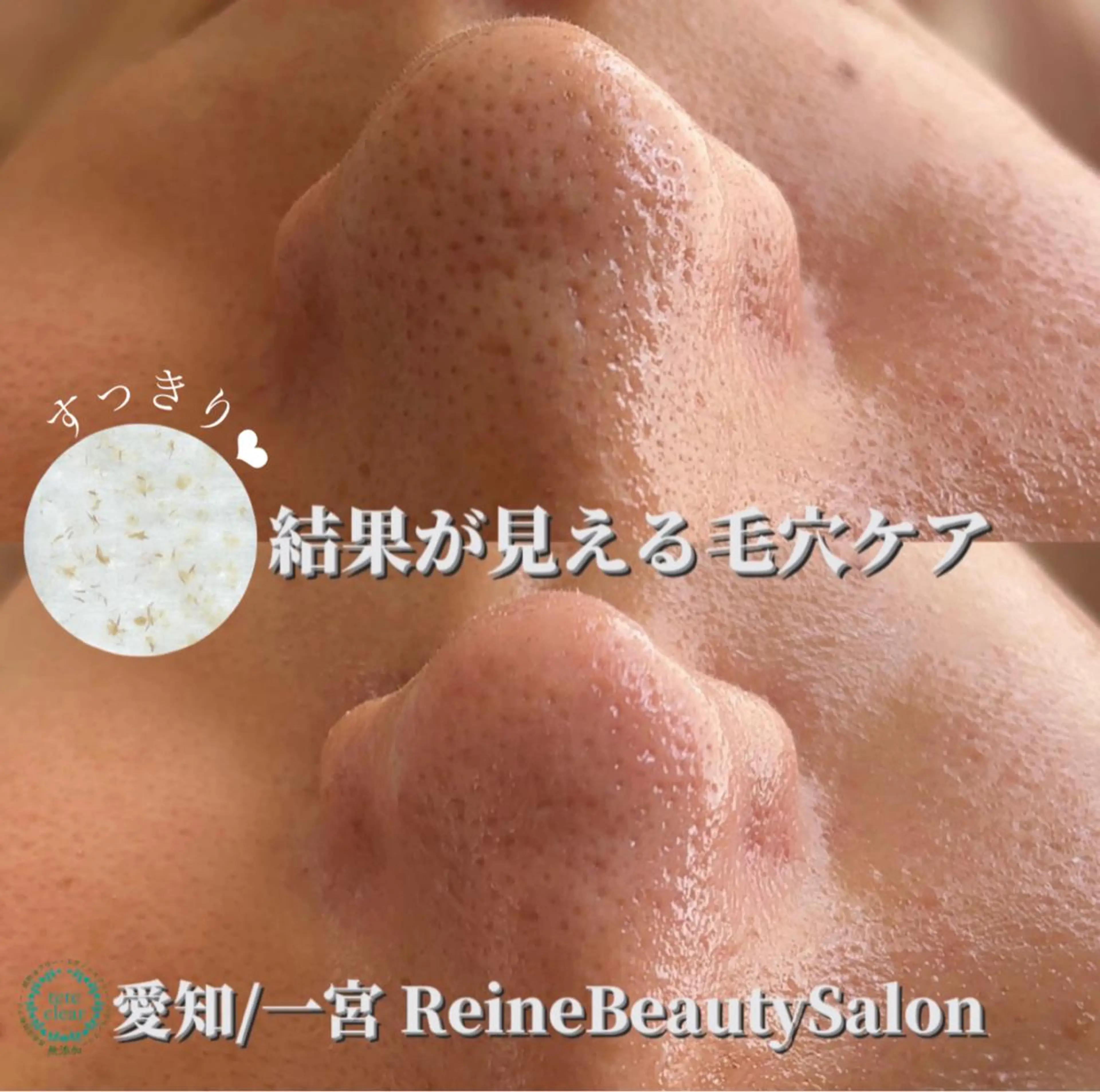 エステ Reine BeautySalon所属・毛穴/シミ肝斑/脱毛 横山梨里のエステ・リラクイメージ