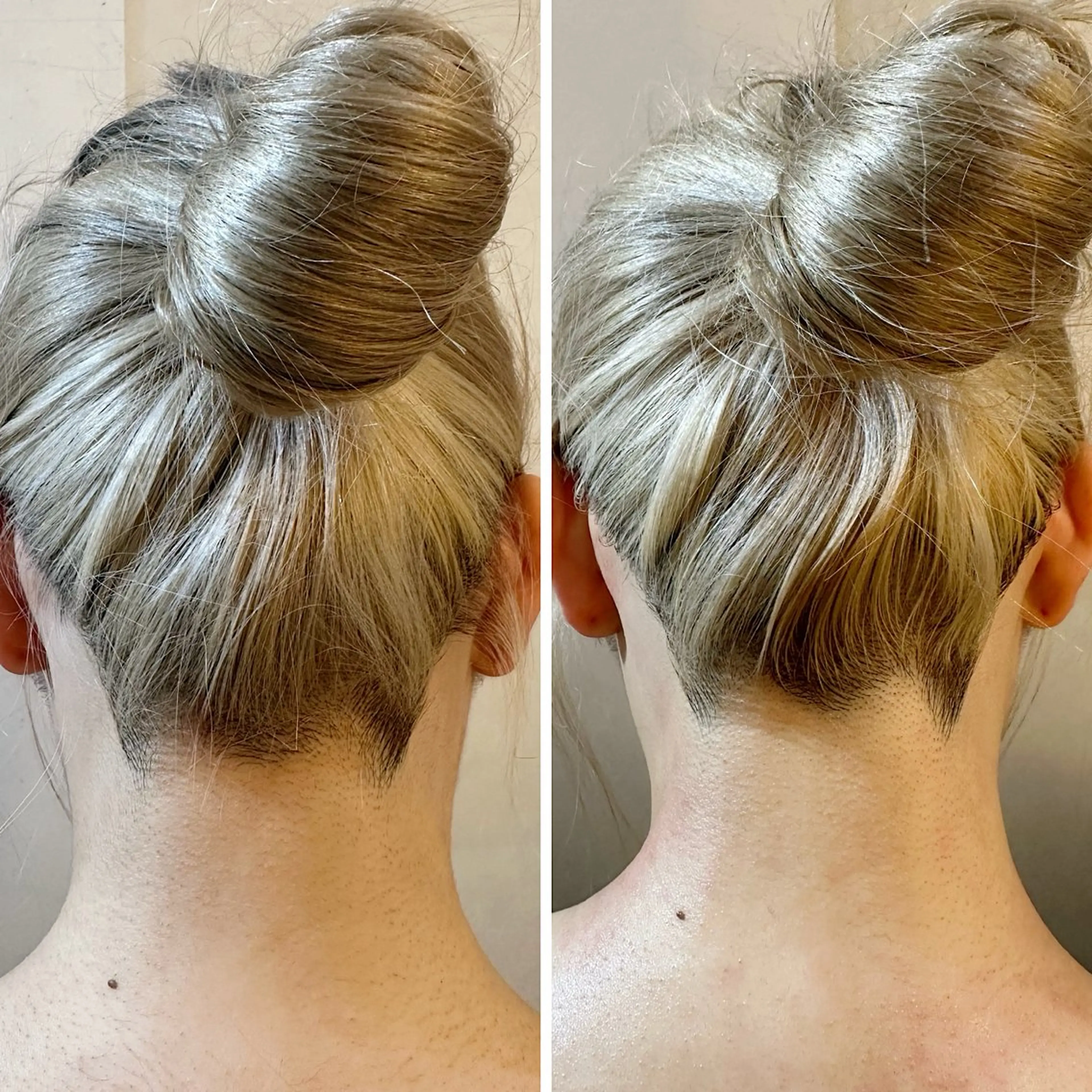 脱毛 うなじ脱毛/美肌脱毛 LABELのエステ・リラクイメージ