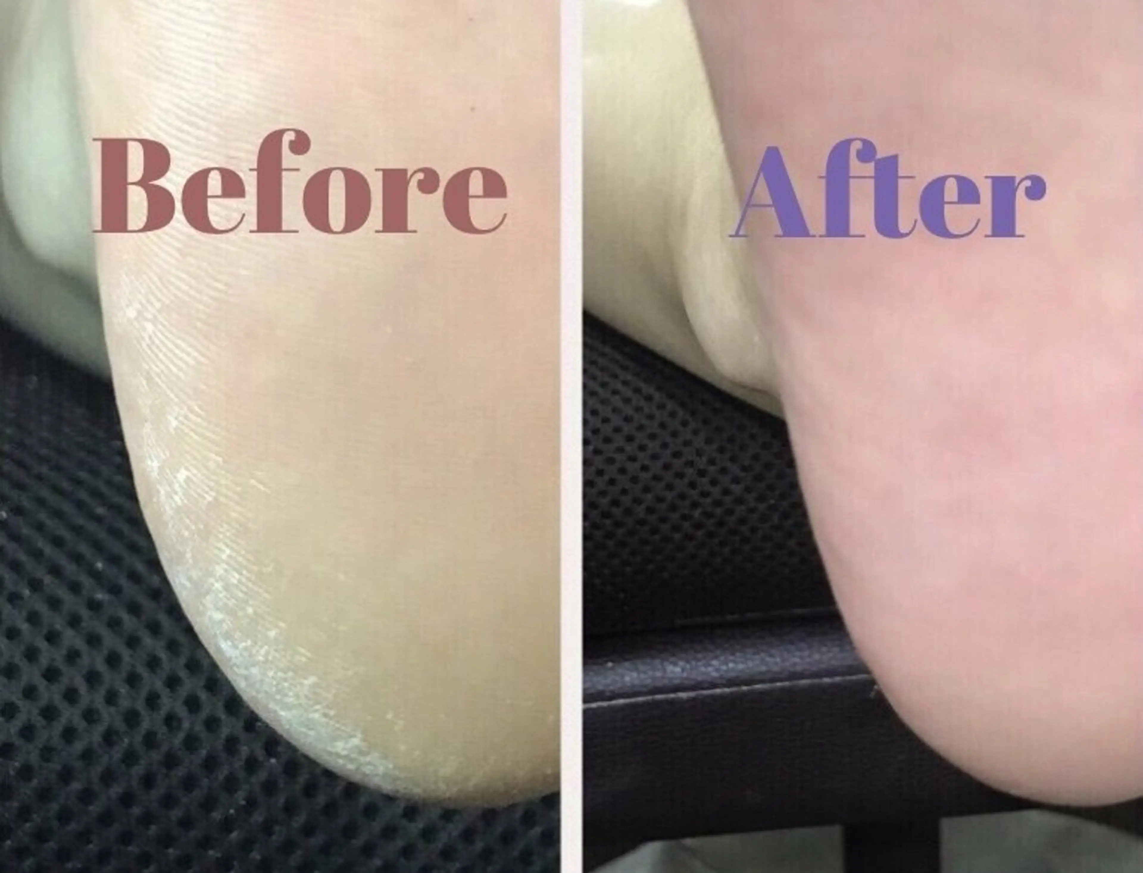 ネイル Nail＆EyeLash Vina ゆめタウン廿日市店所属・屋野丸 飛雪のネイルデザイン