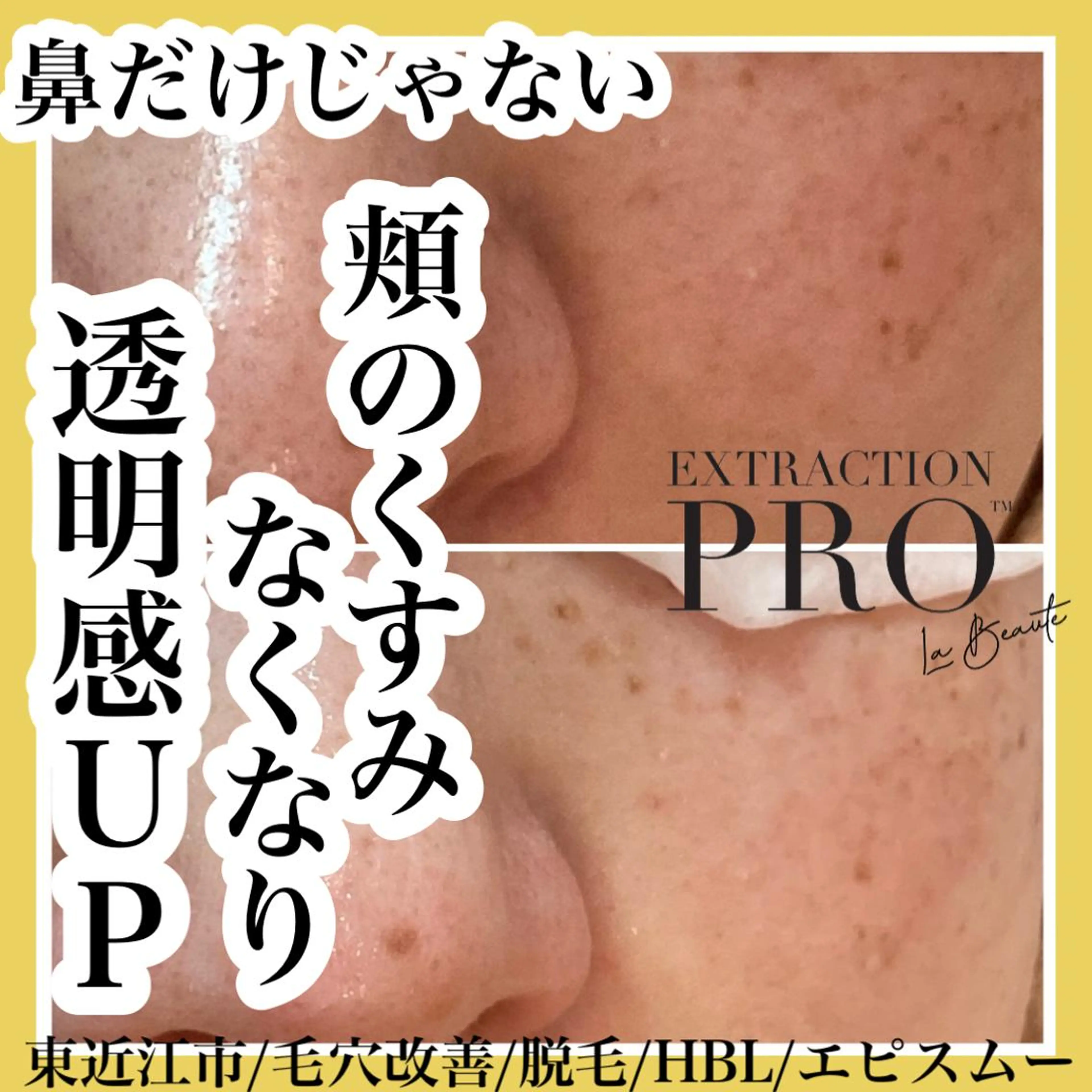 epismoo 脱毛/HBL/毛穴の眉毛・アイブロウイメージ