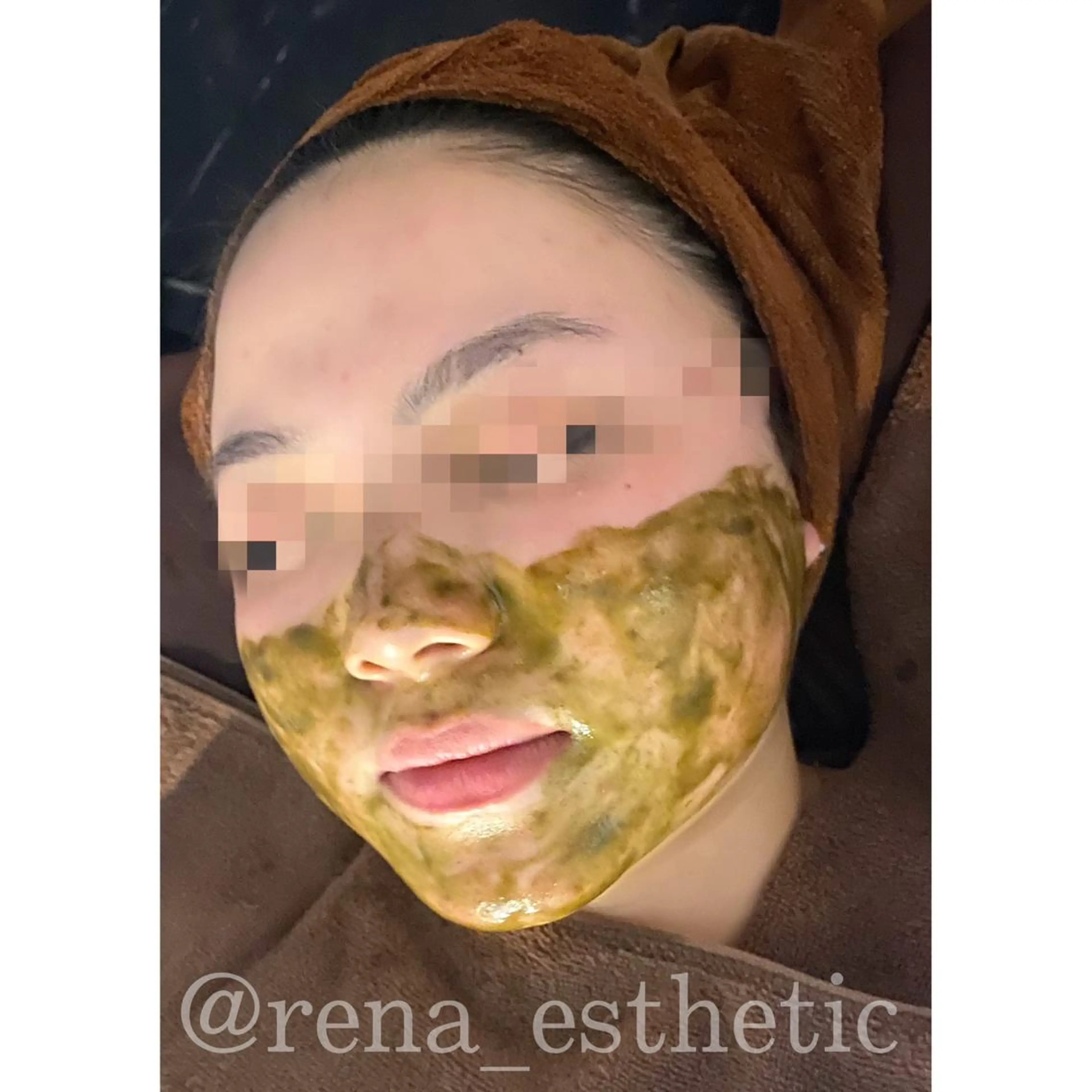 ハーブピーリング・毛穴ケア専門サロンSalon de LENA所属・ハーブピーリング 専門店/名古屋駅前店のエステ・リラクイメージ