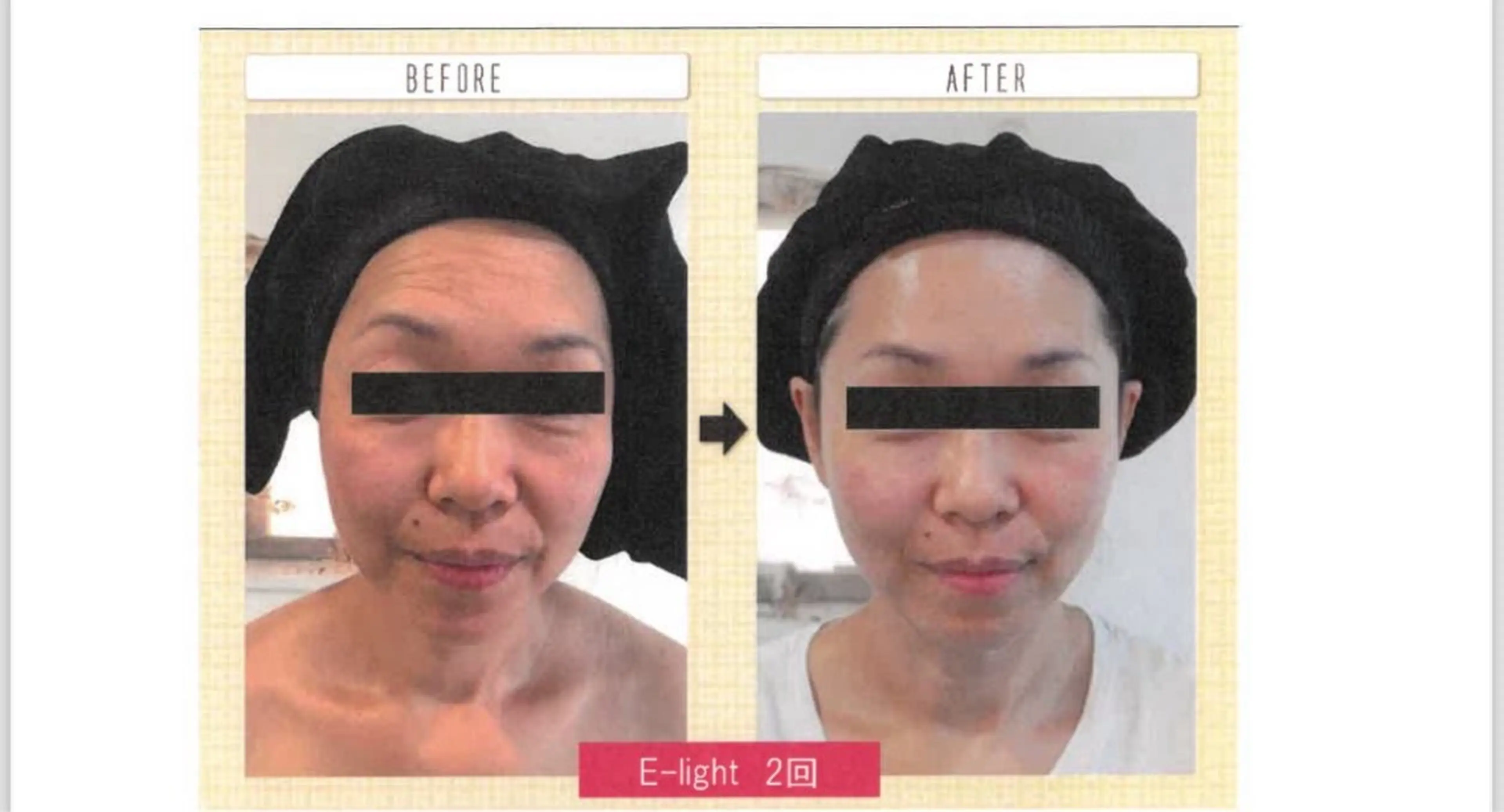 エステ リラク private salon meのエステ・リラクイメージ