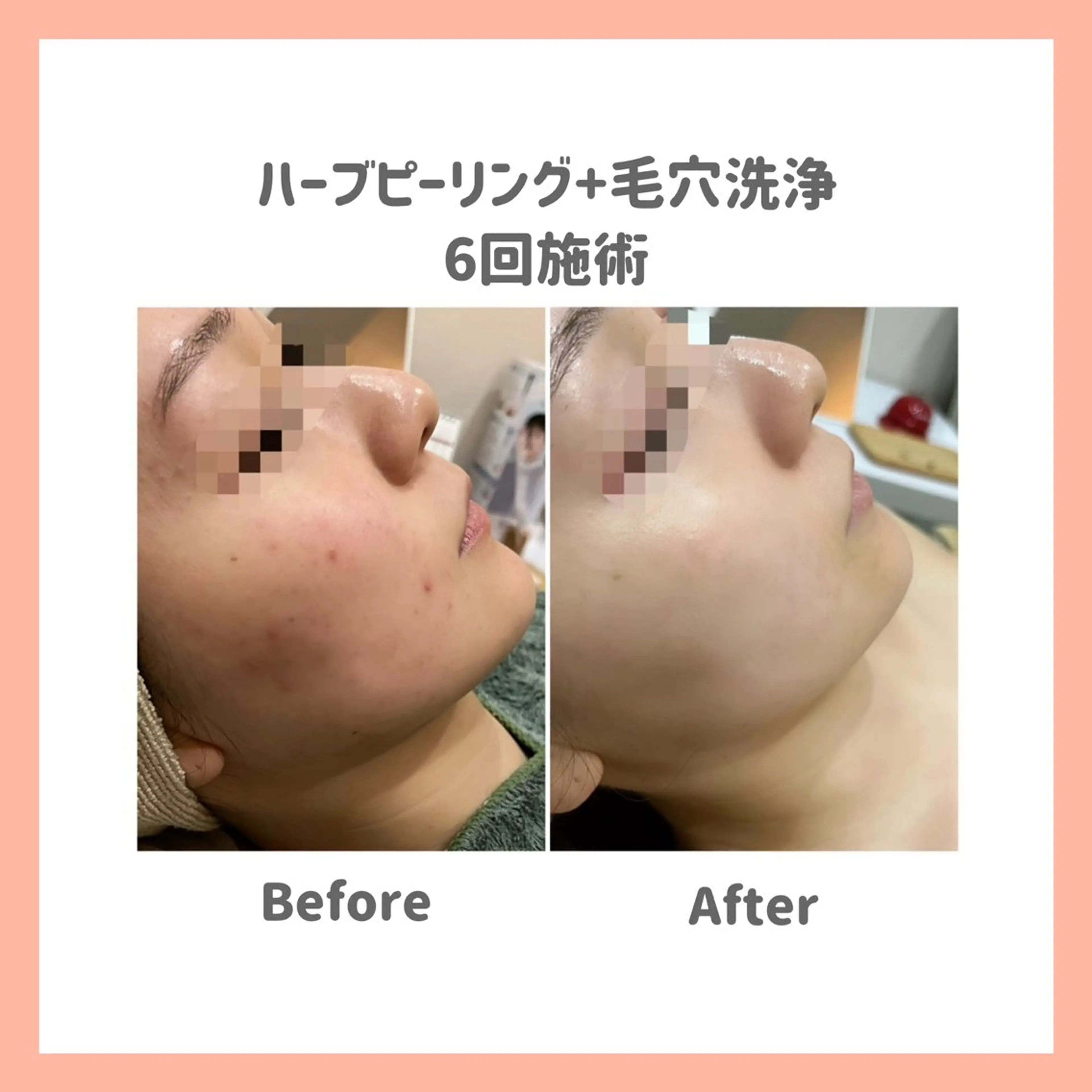 エステ 脱毛&フェイシャル 専門店muro.のエステ・リラクイメージ