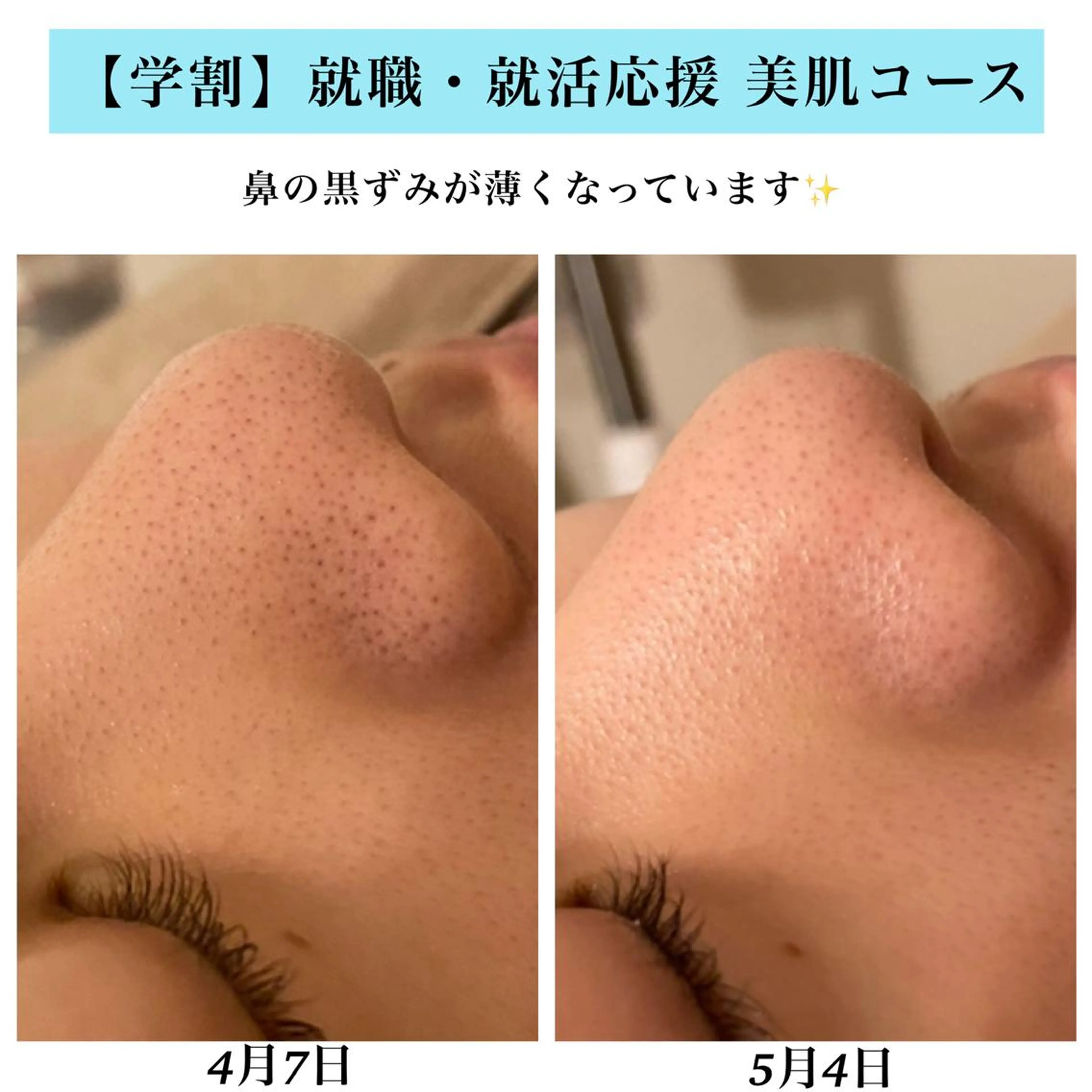 エステ Bellesthe （ベルエステ）のエステ・リラクイメージ