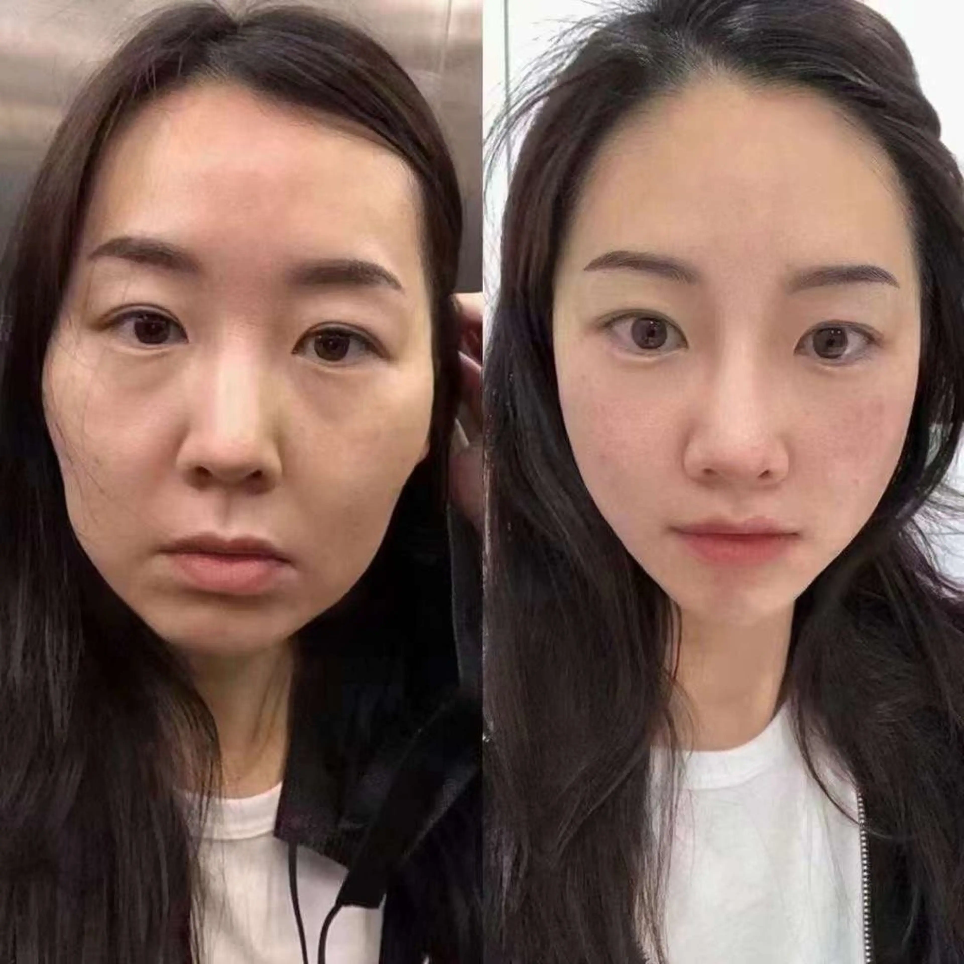 ネイル エステ aliaハイフ&水光ジェットサロン所属・aliaハーブ水光店 エステティシャン募集のエステ・リラクイメージ