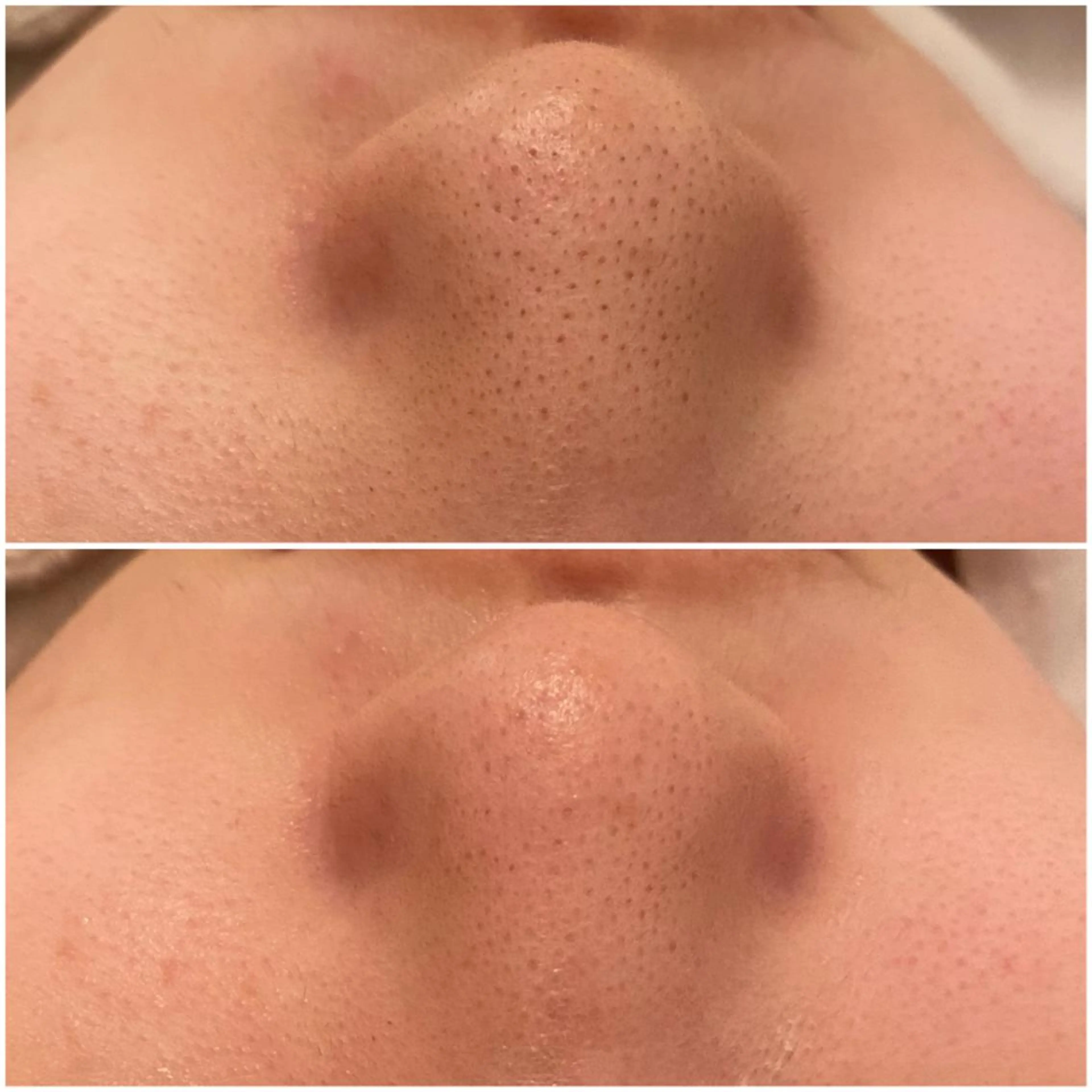 ✨美肌水光✨ アトリエリュバンのエステ・リラクイメージ