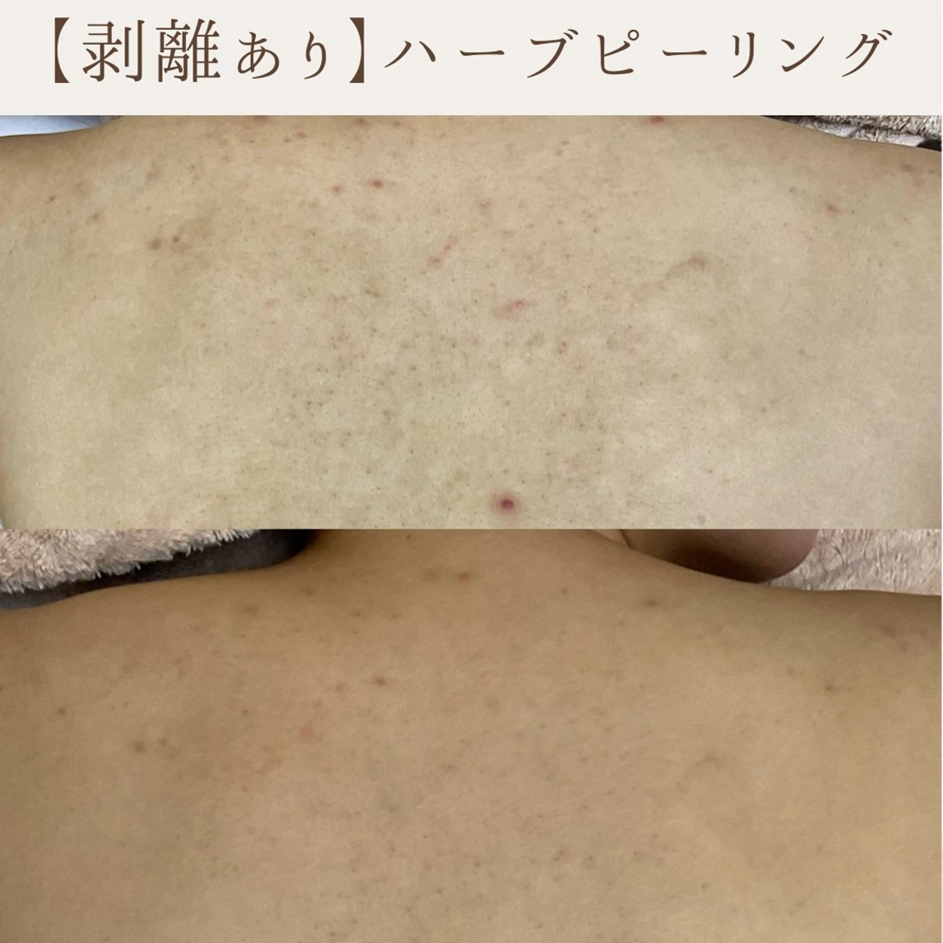 エステ 肌質改善サロン renew所属・肌質改善サロン renew/ｳｴｷのエステ・リラクイメージ