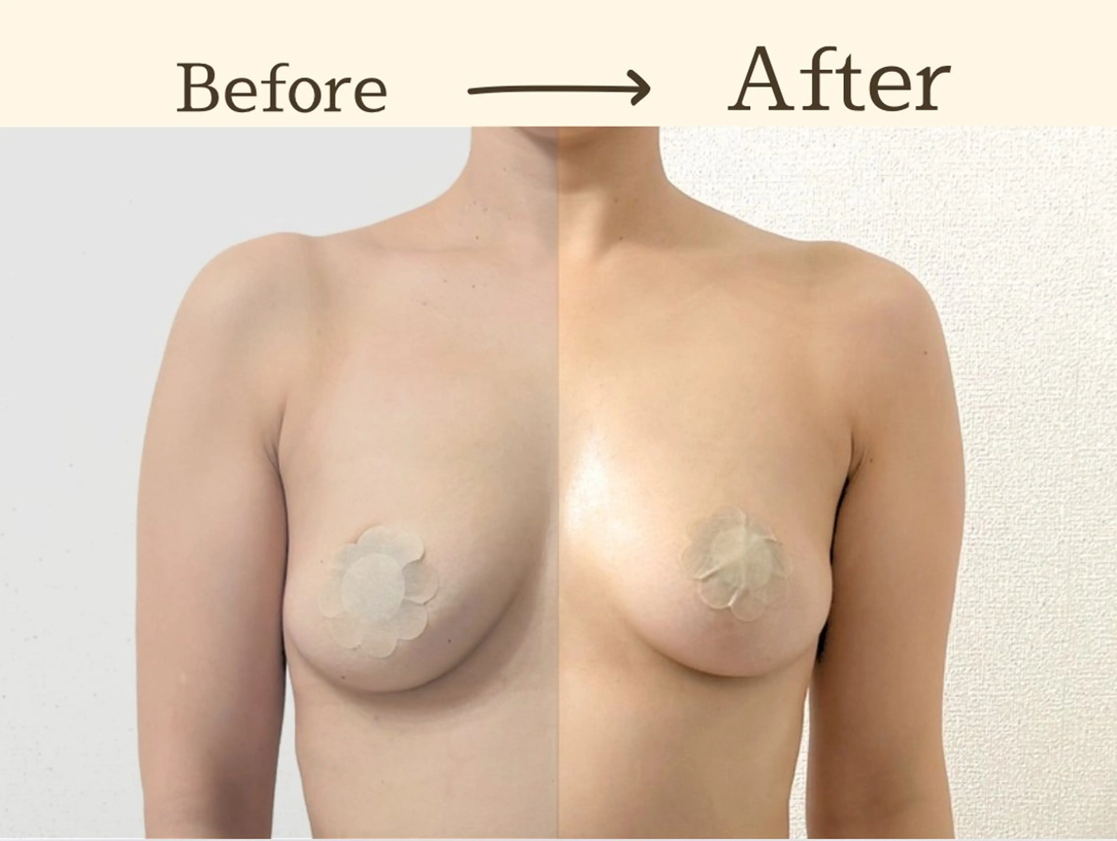 【下垂/左右差/流れ】が気になる方向けオーダーメイド施術　90分の写真