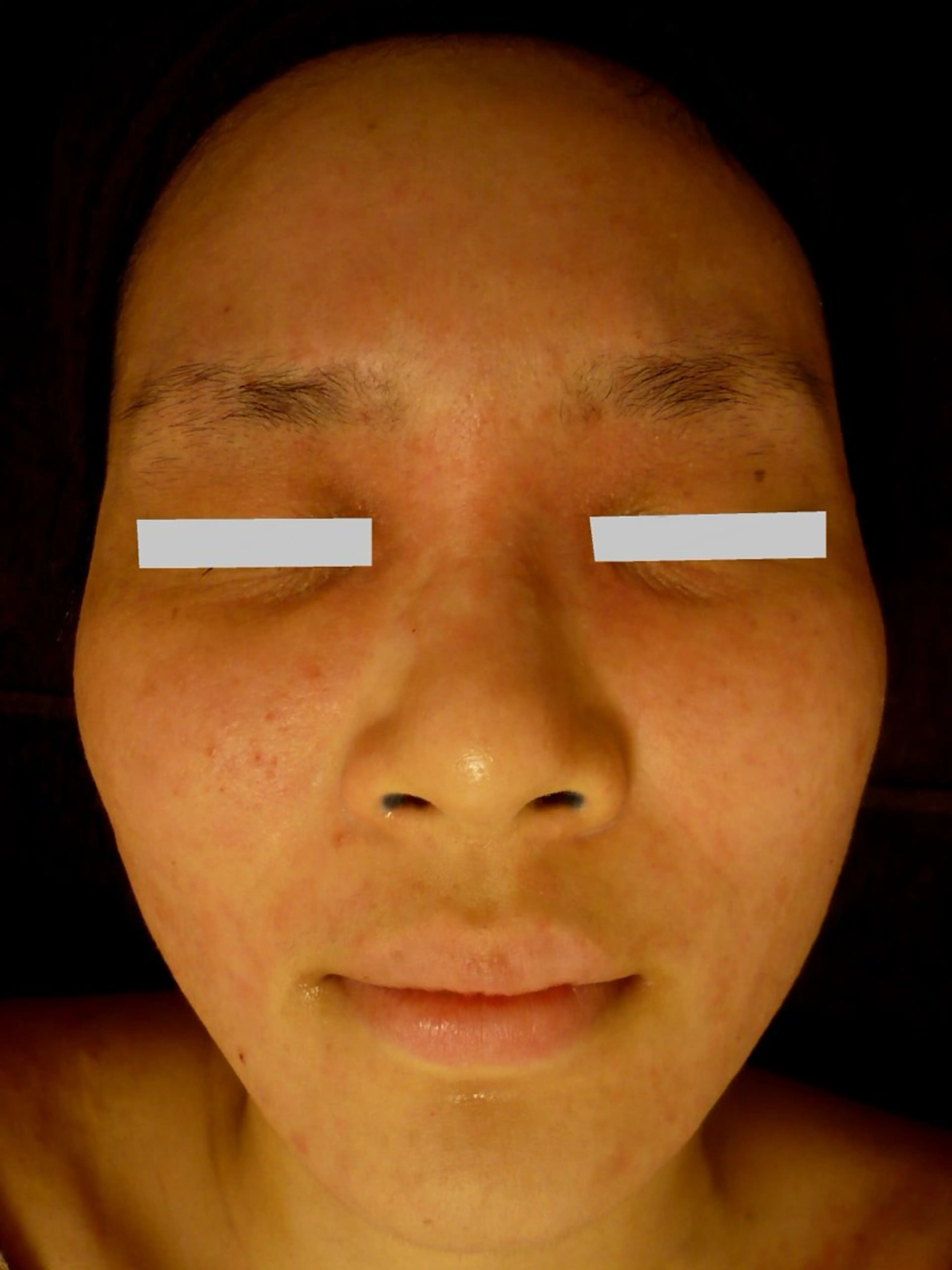 ピーリングサロン シャンテール所属・ピーリングサロン シャンテールのエステ・リラクイメージ