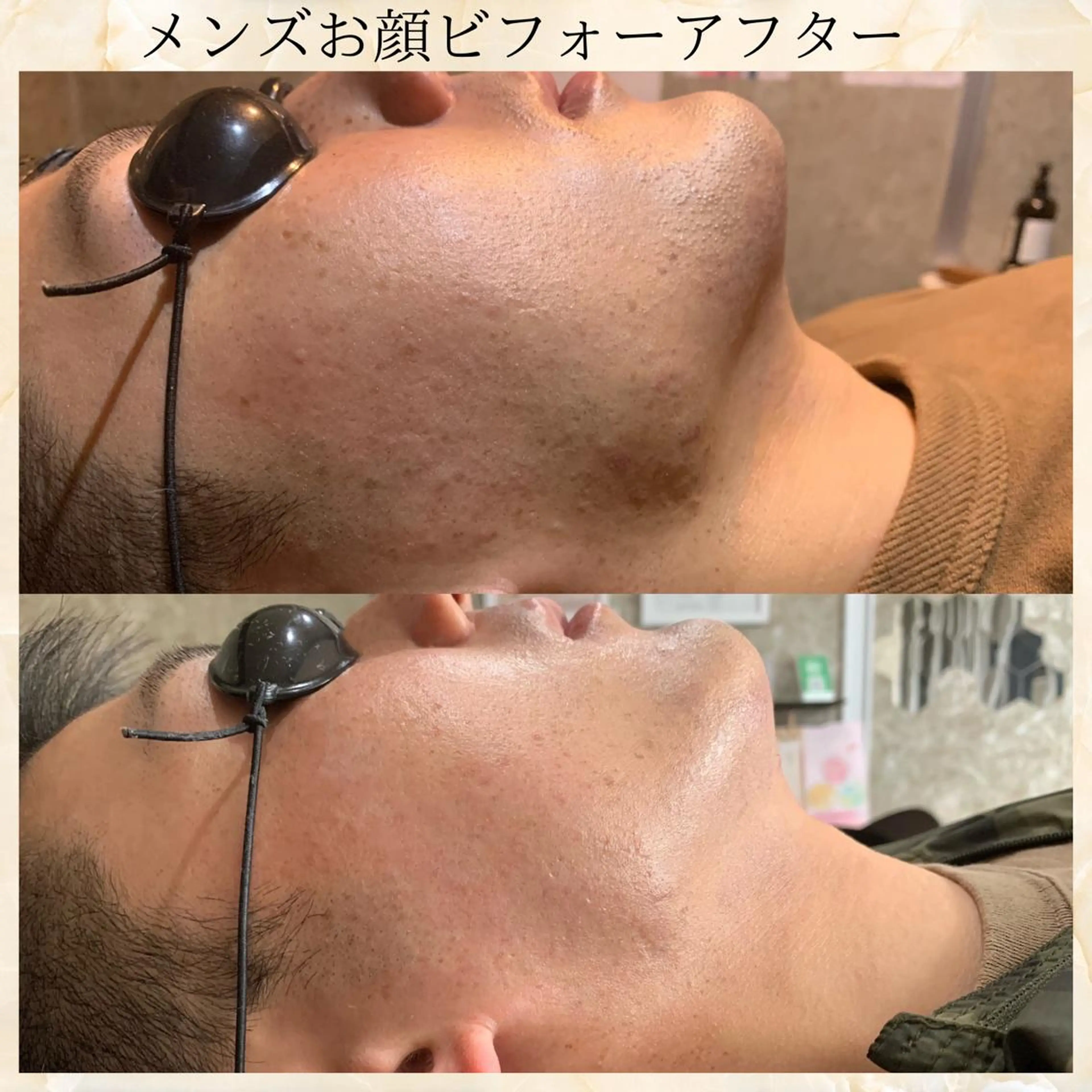 メンズ 20代から始める脱毛 salonLEPIAのエステ・リラクイメージ