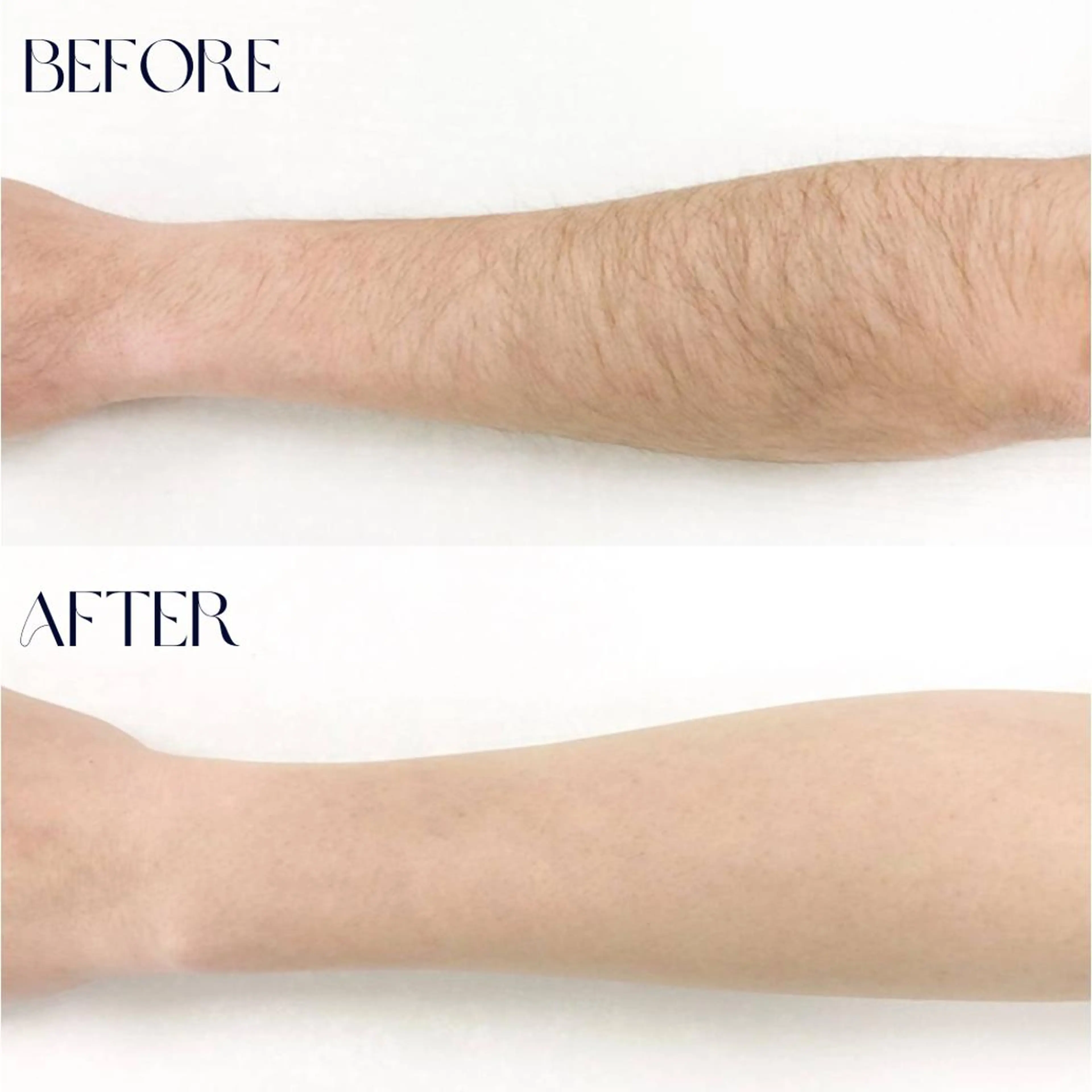 その他 B-st. 下北沢のエステ・リラクイメージ