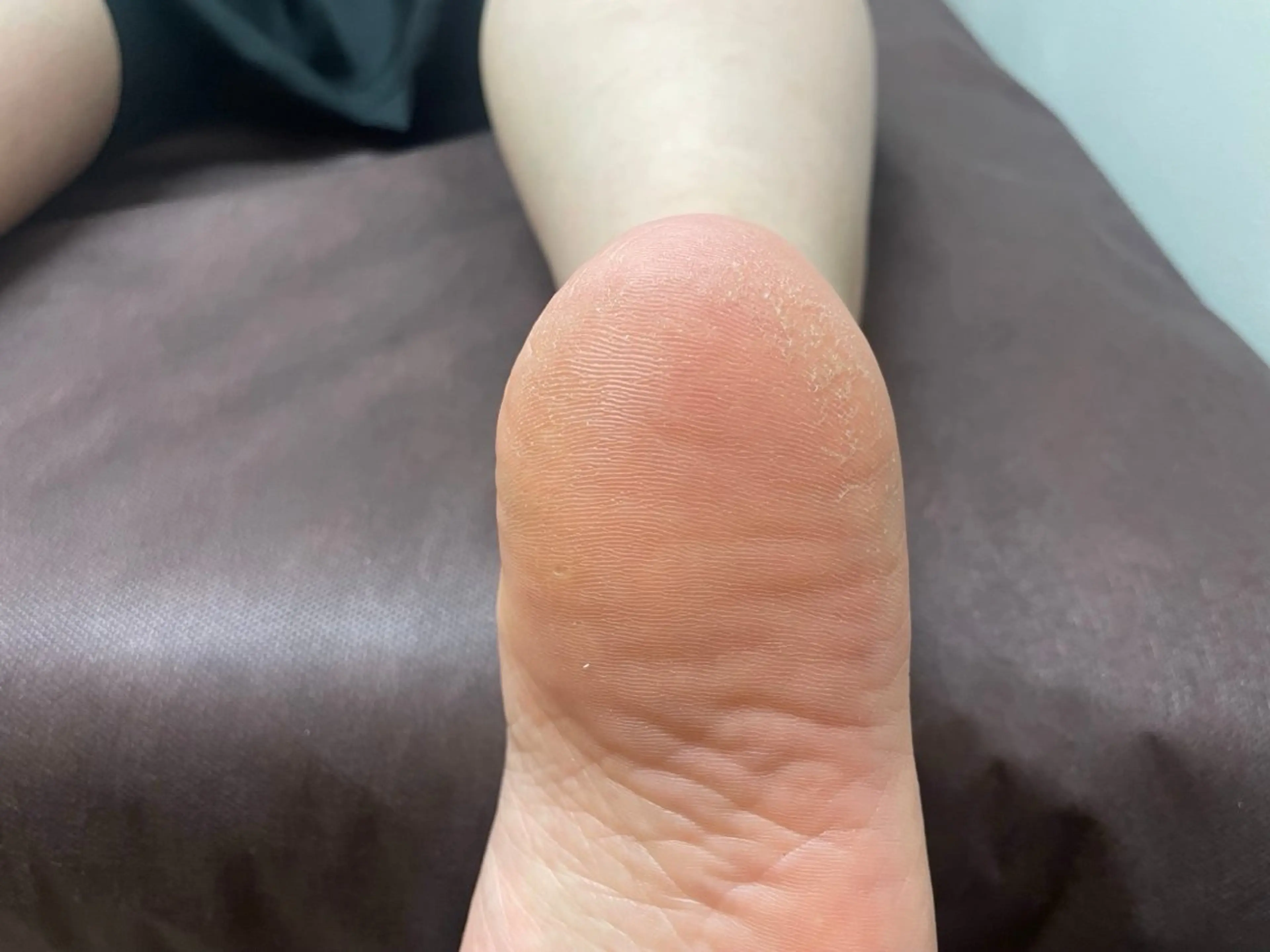 ネイル フットネイル ネイルサロンnico 安田のネイルデザイン