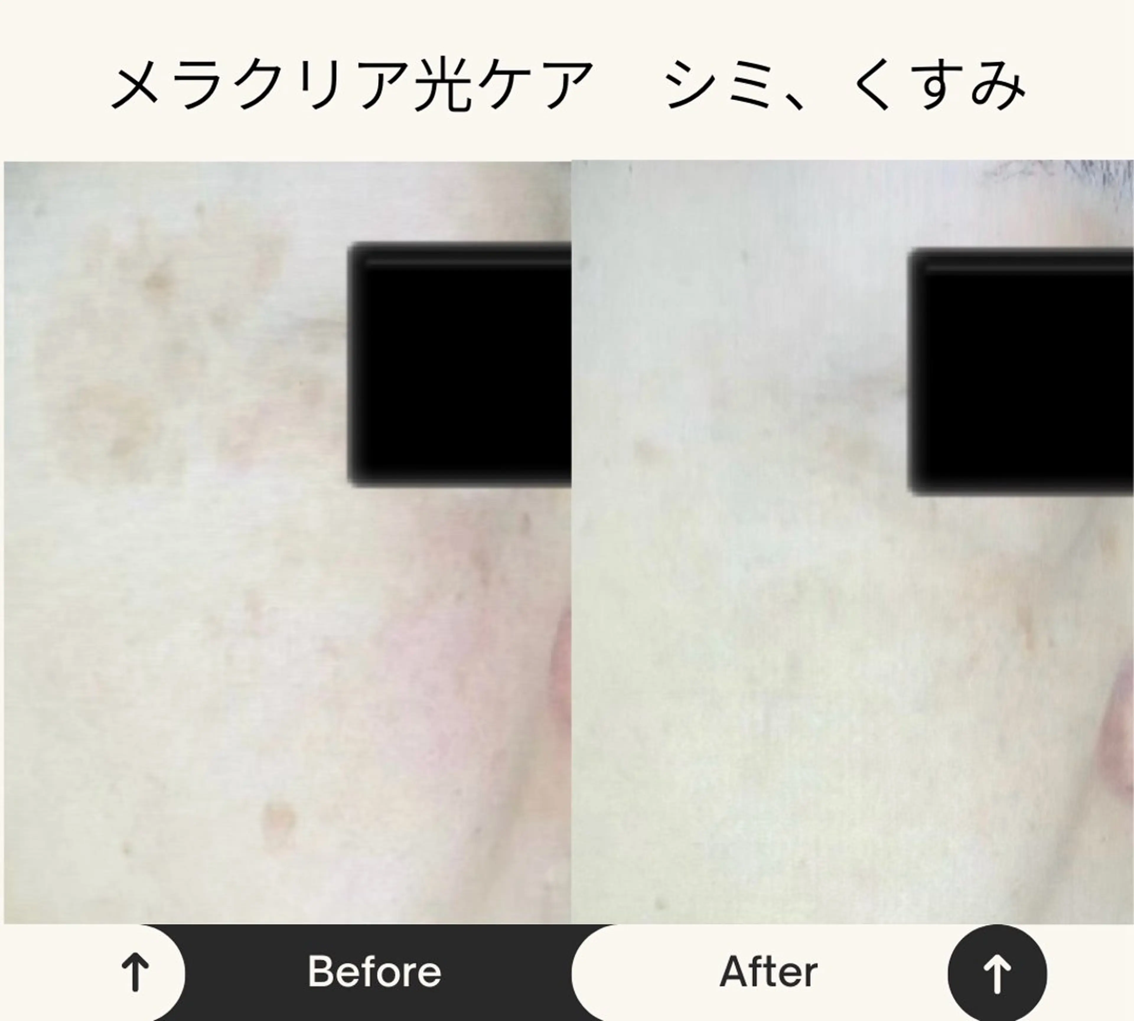 光美容シャムロック バスト、シミ専門店のエステ・リラクイメージ