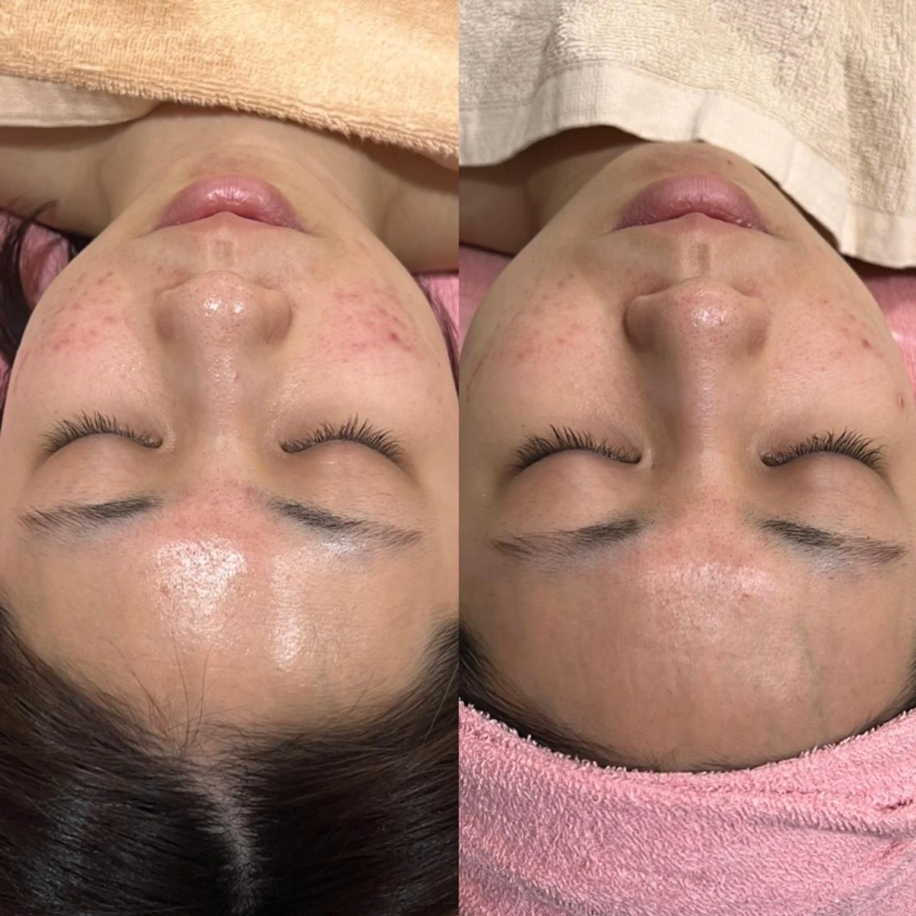 フェイシャル/脱毛 ジョアアンジェ　田中のエステ・リラクイメージ