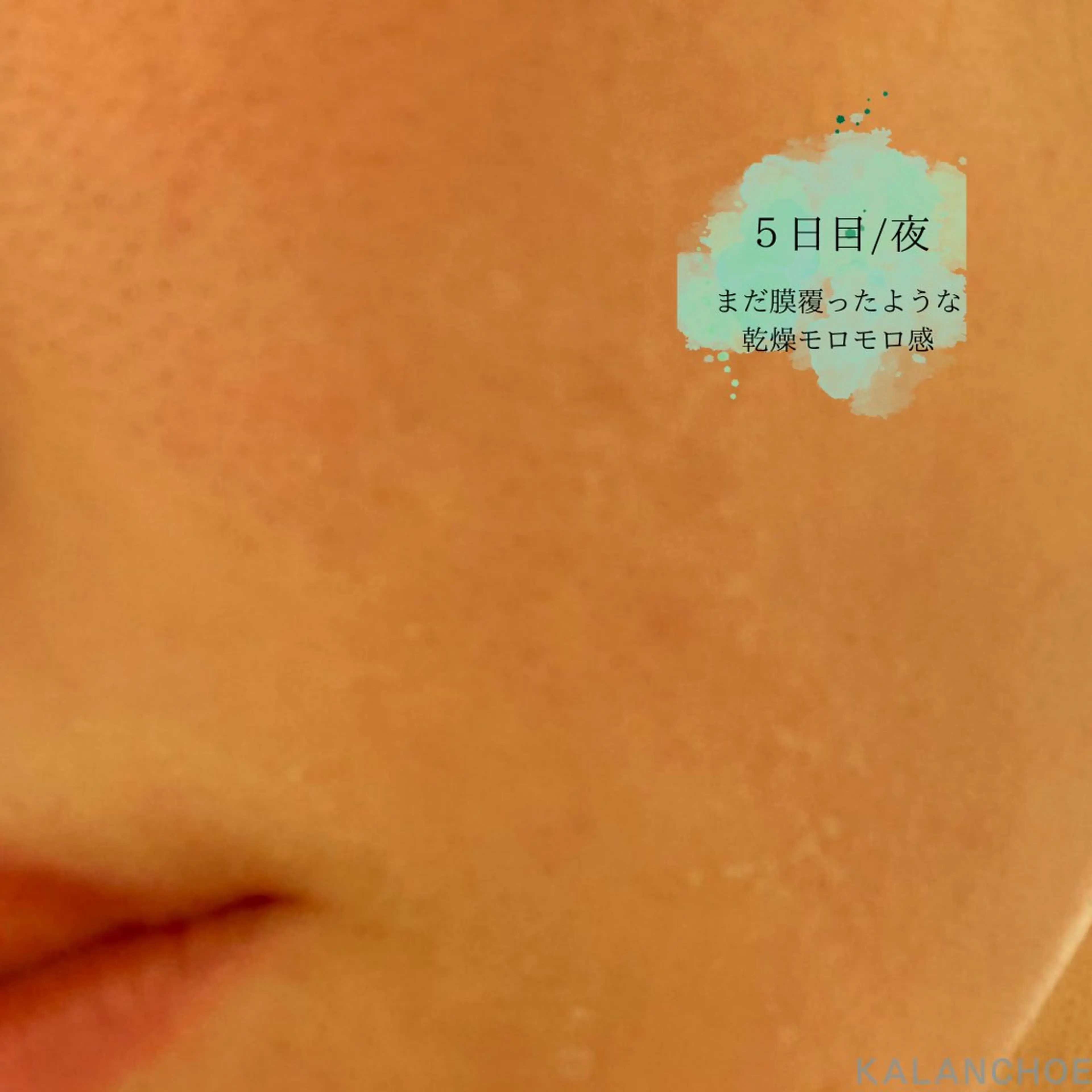 エステ 肌質改善 KALANCHOEのエステ・リラクイメージ