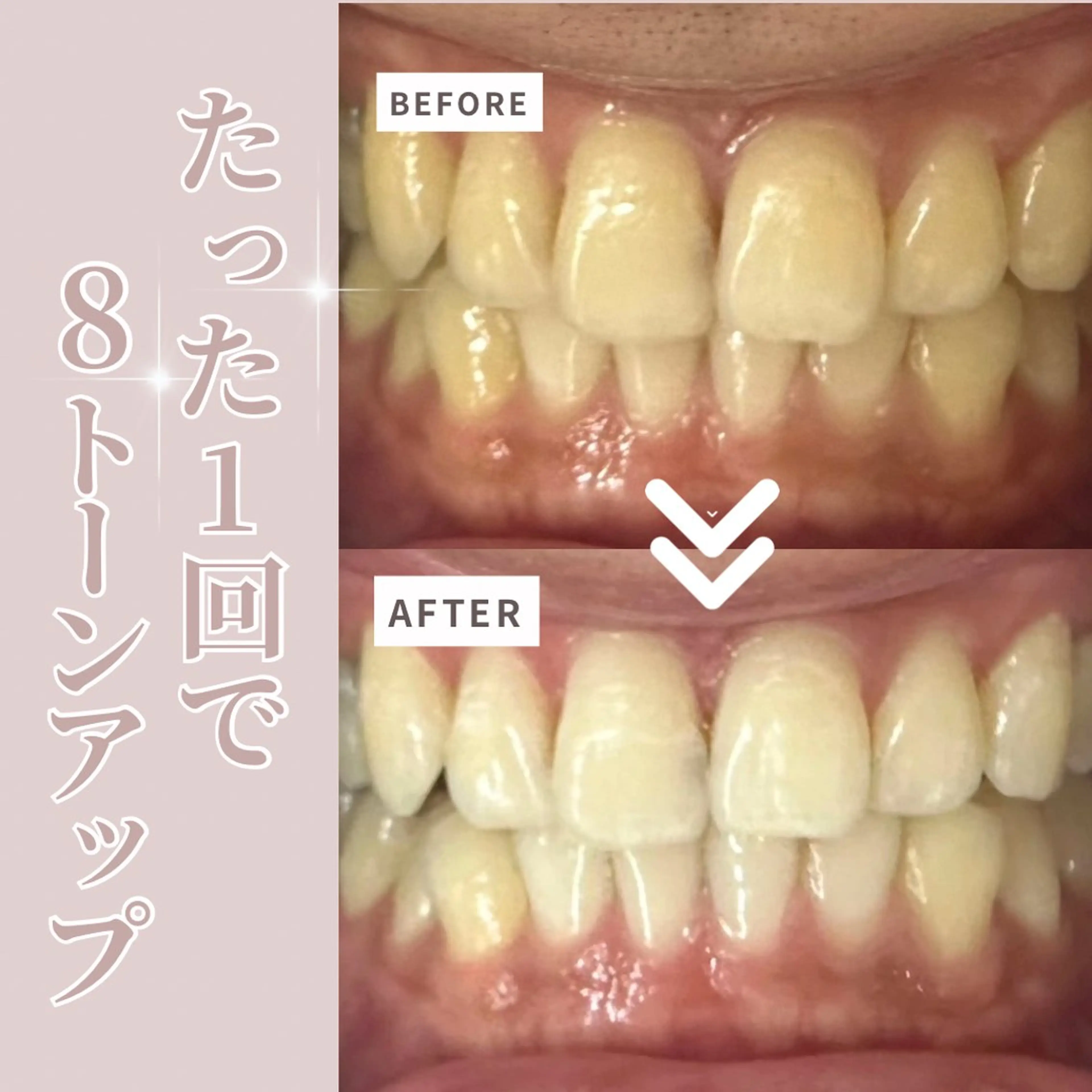 その他 LIBRA自由が丘所属・LIBRA自由が丘 ホワイトニングのその他イメージ