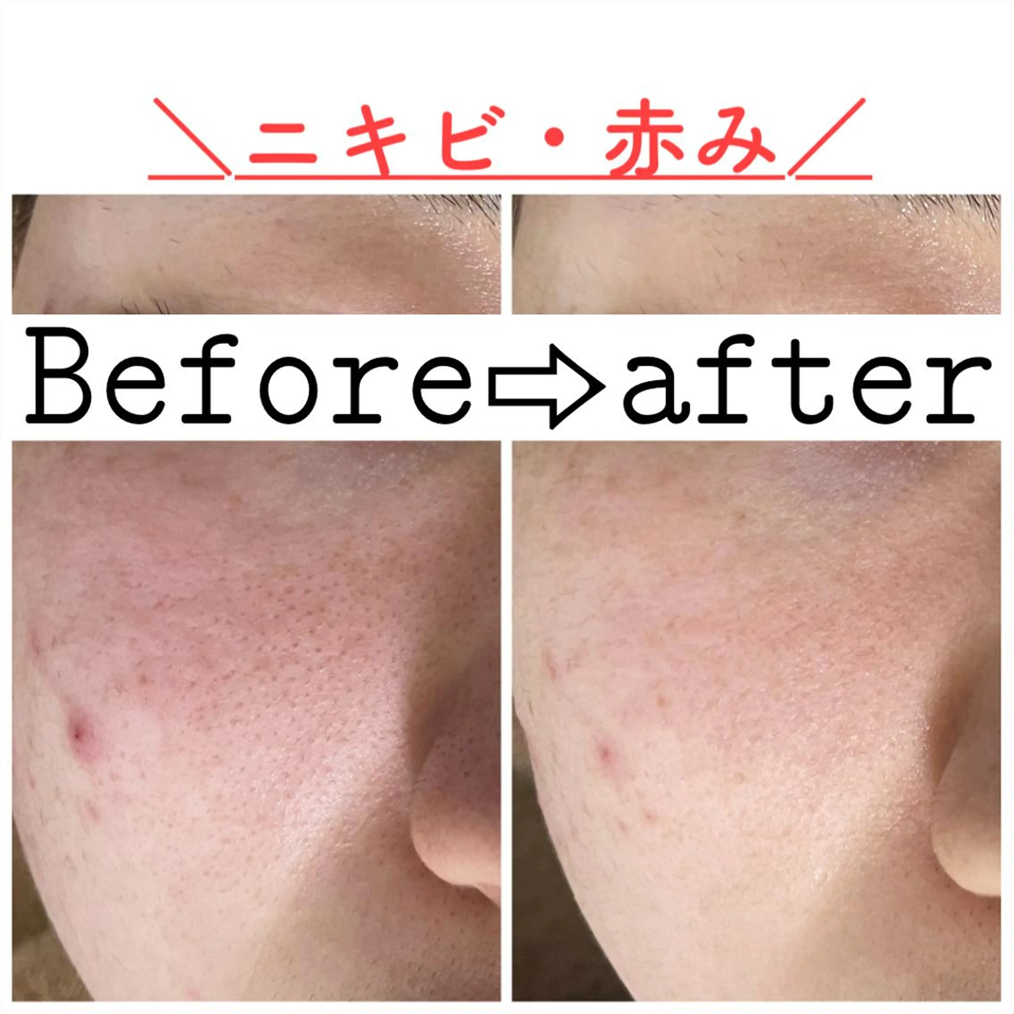 ショート カラー パーマ ヘアアレンジ メンズ キッズ ネイル マツエク・マツパ エステ ニキビ&跡改善サロン オーナー光木のエステ・リラクイメージ