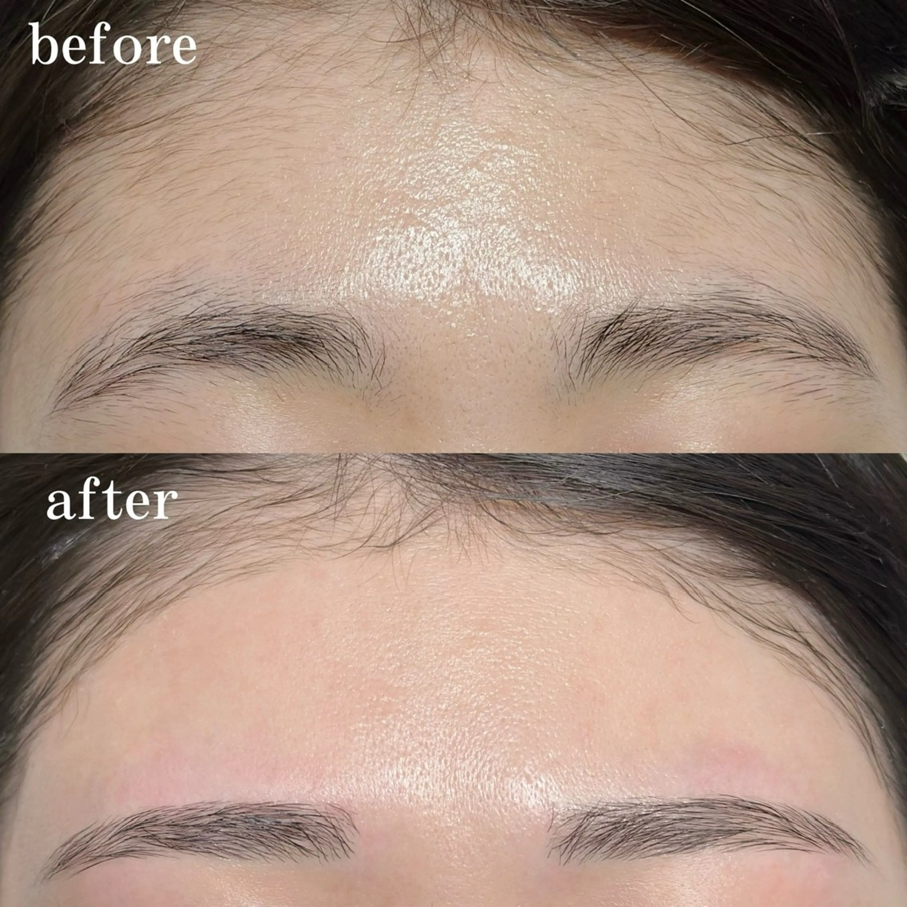 《💆🏻ツルツル美顔💆🏻》美眉アイブロウWAX＋フルフェイス 保湿+眉仕上げ込の写真