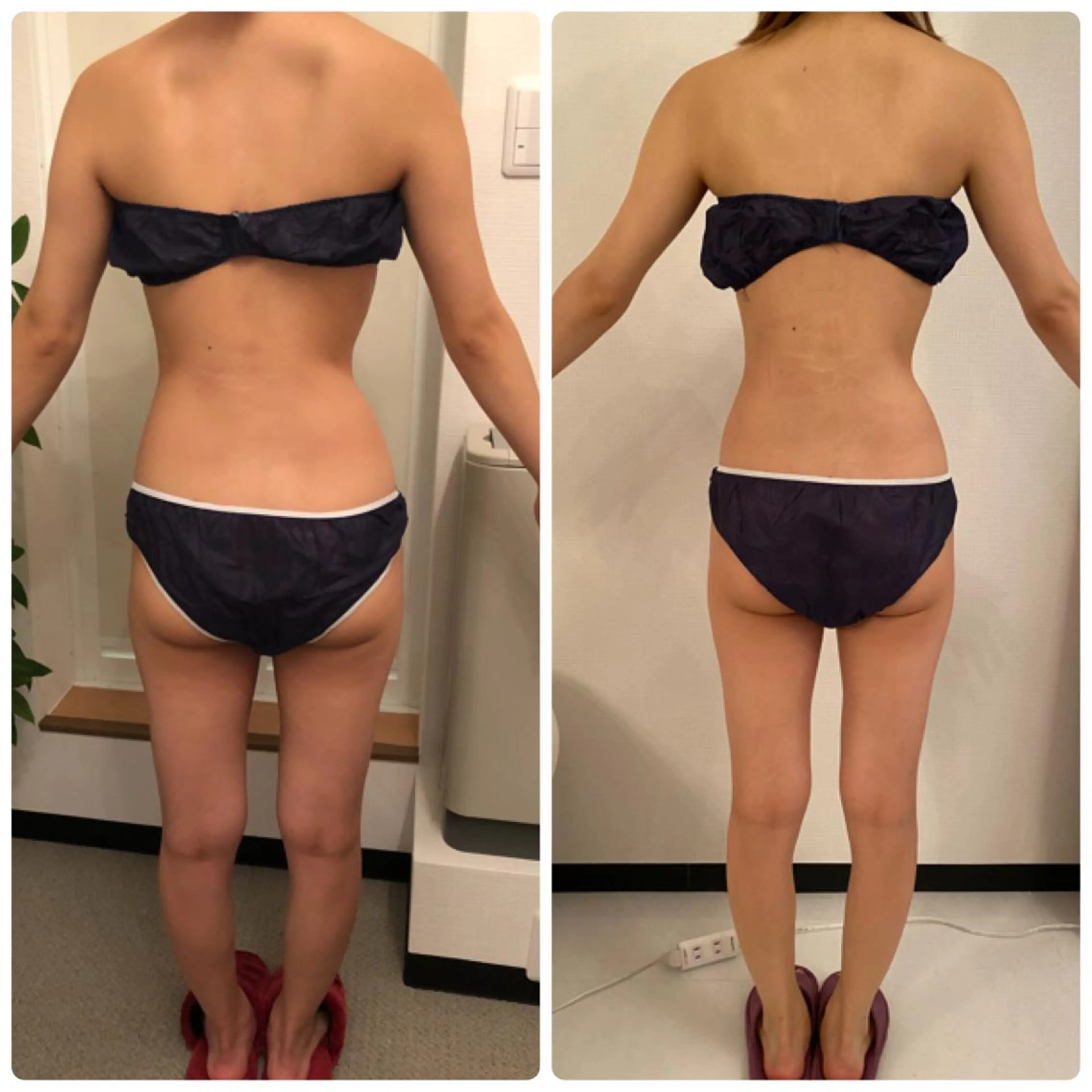 FLEUR大阪・整体 ・ハイフ・痩身・小顔のエステ・リラクイメージ