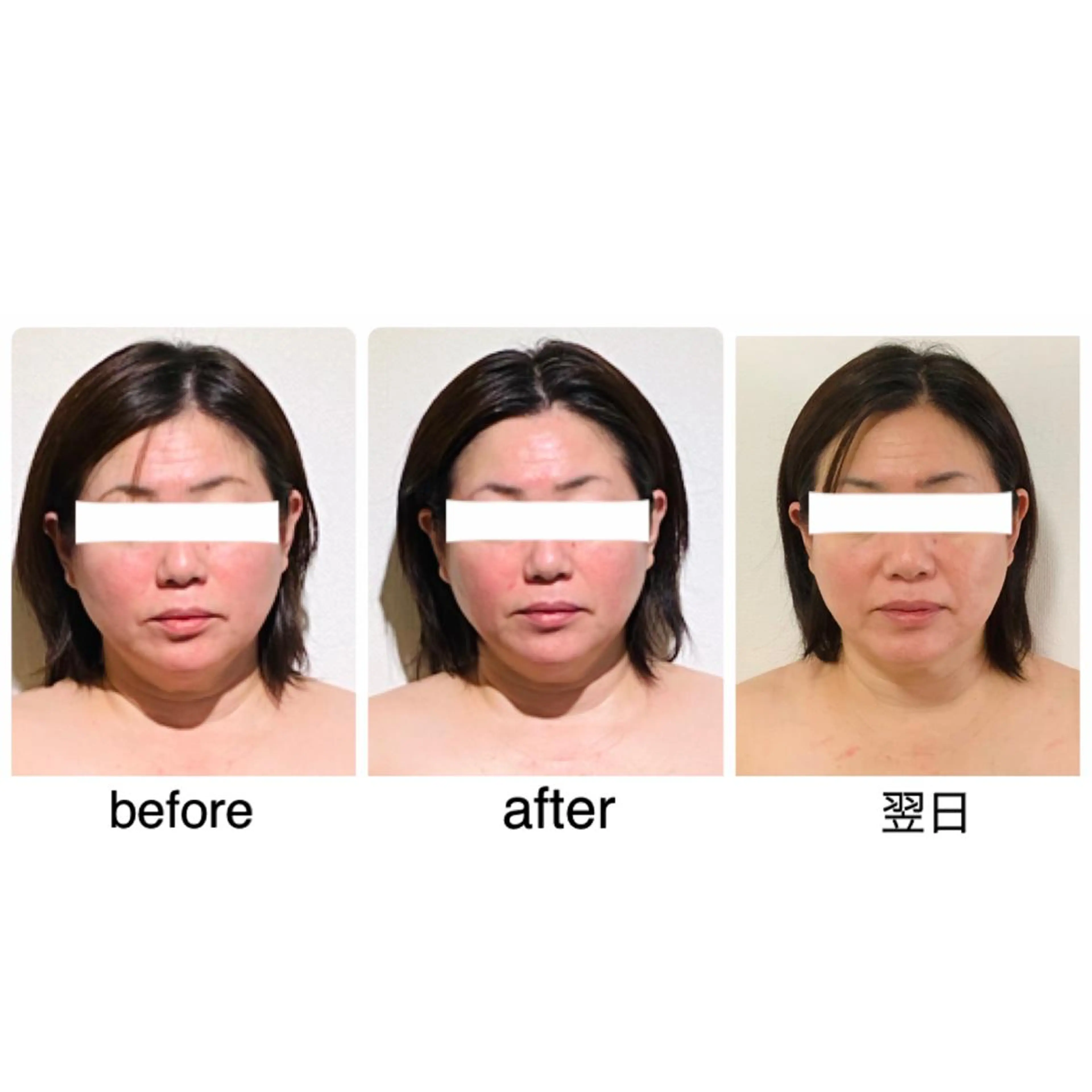 ショート カラー ヘアアレンジ ネイル 小顔矯正専門サロンジュマリ所属・町田 淳子のエステ・リラクイメージ