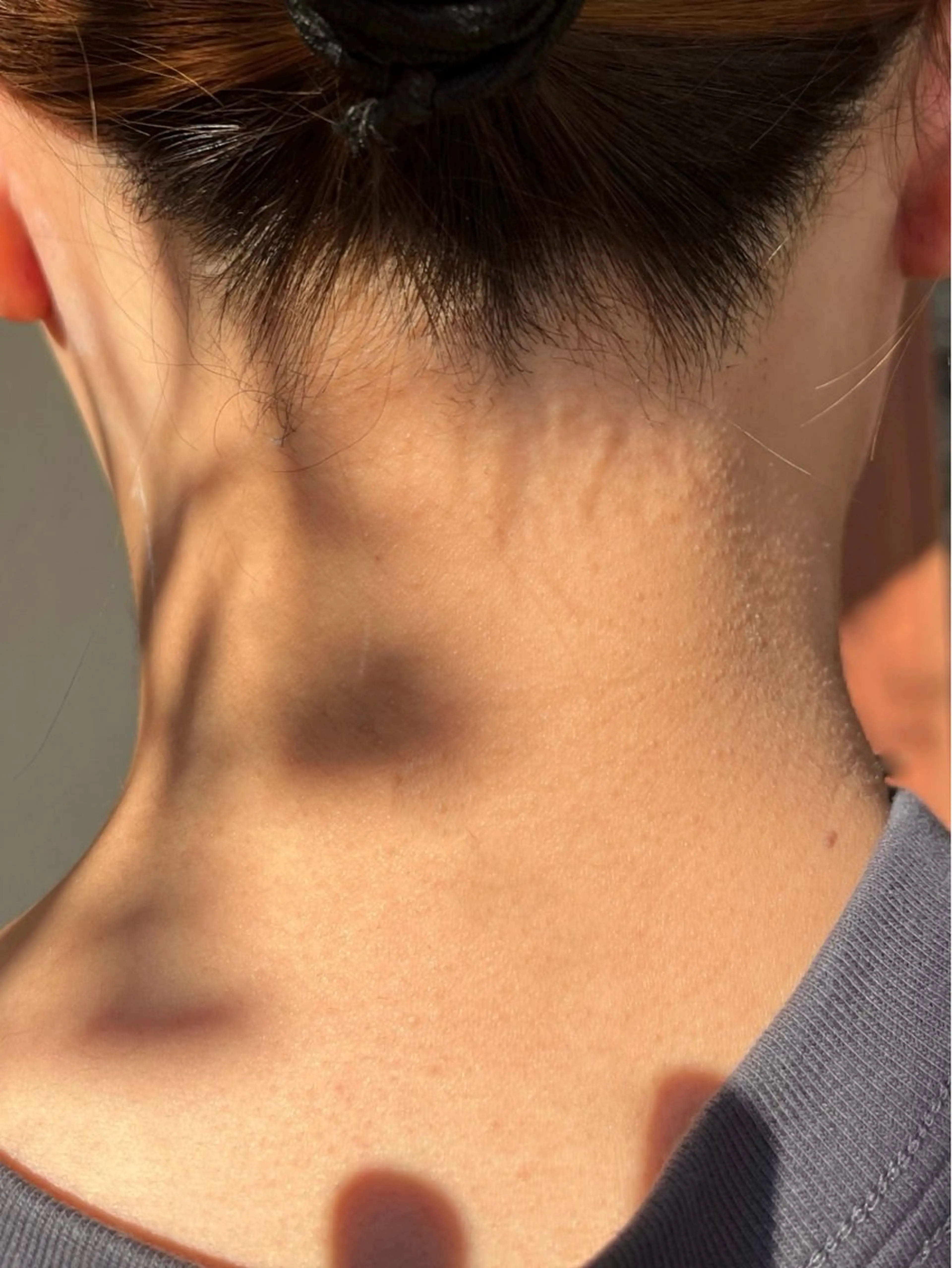 ［　］Shiro Meiのエステ・リラクイメージ