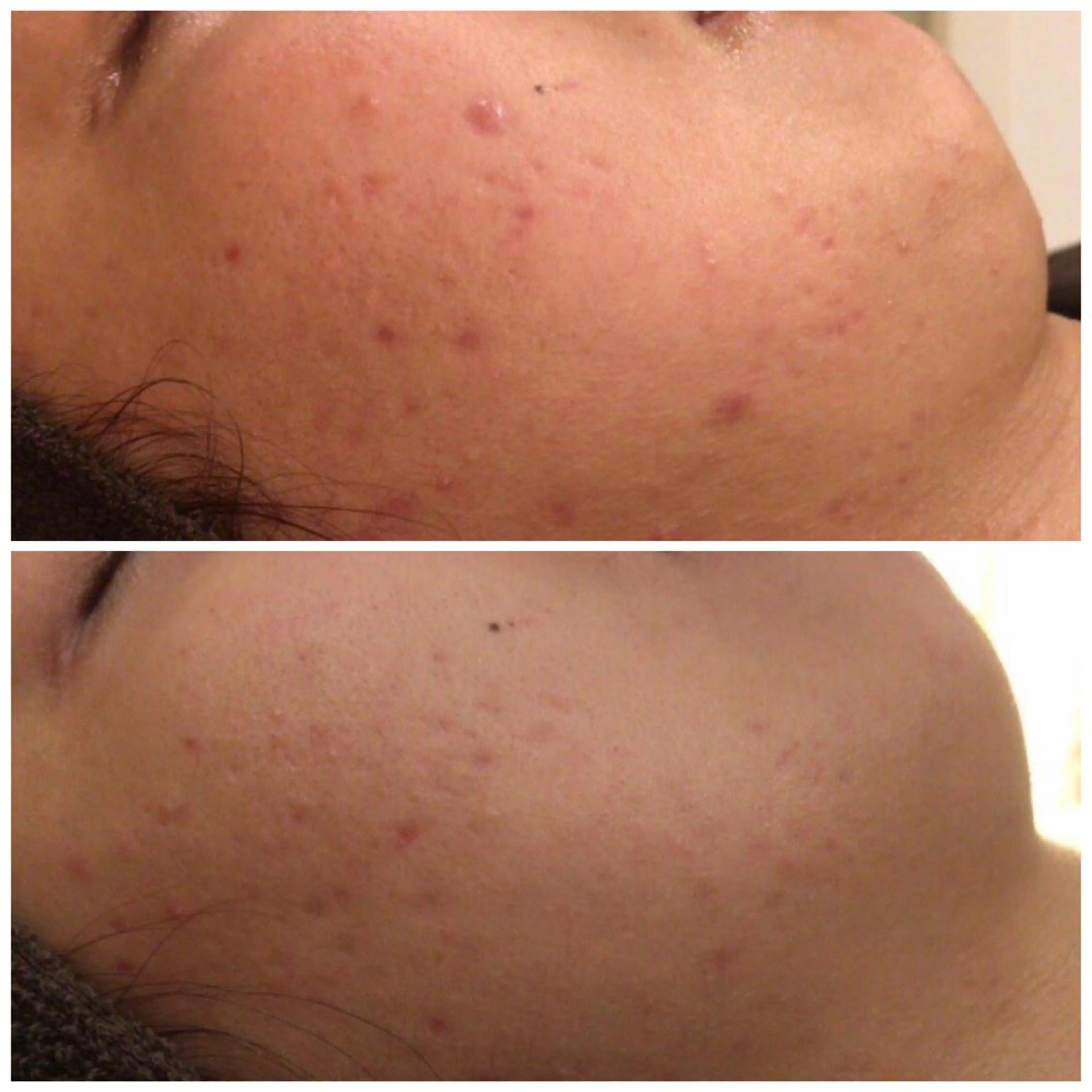 触れたくなる モテ肌へ...❤︎のエステ・リラクイメージ