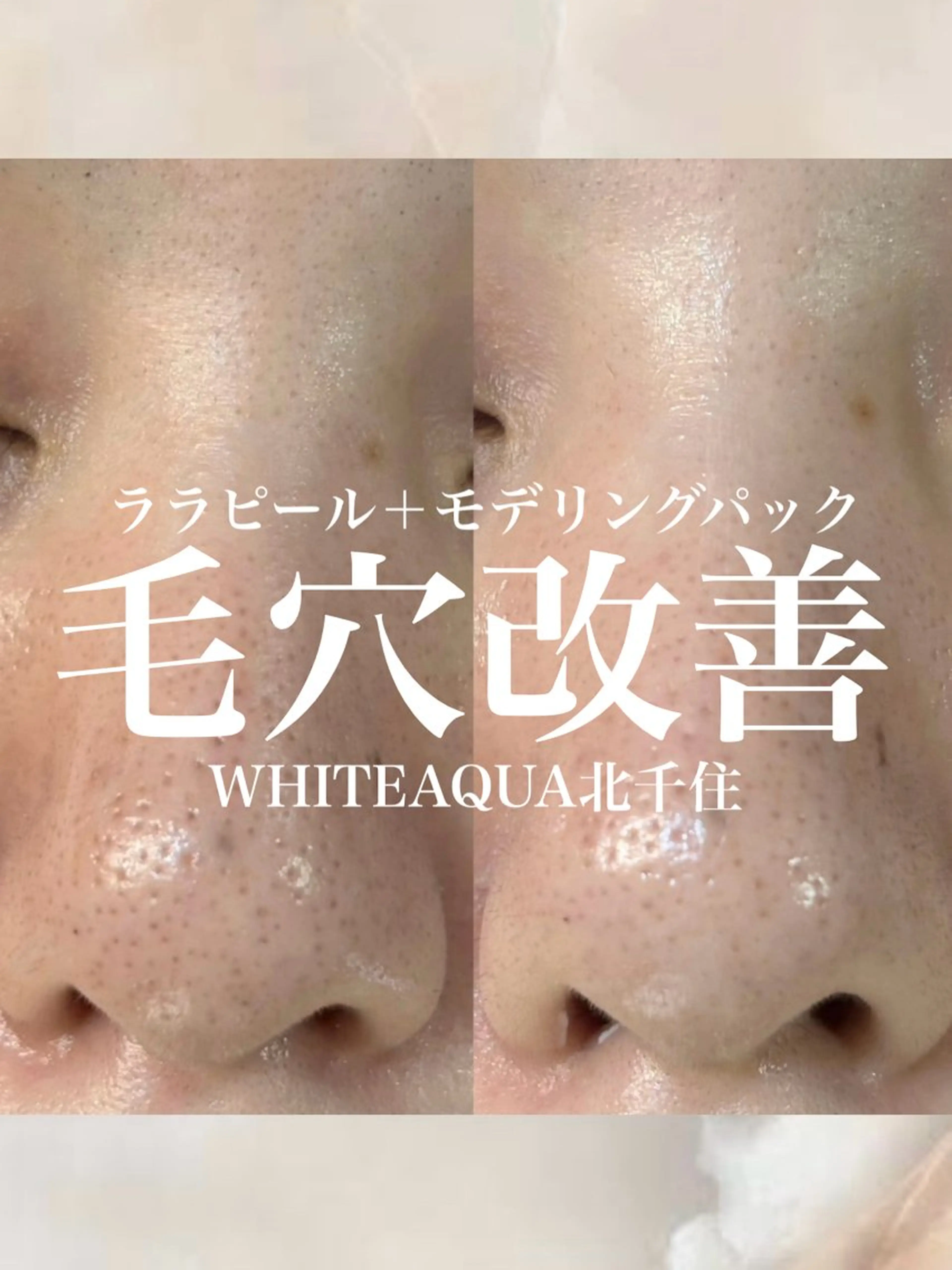 エステ WHITE AQUA 北千住店のエステ・リラクイメージ