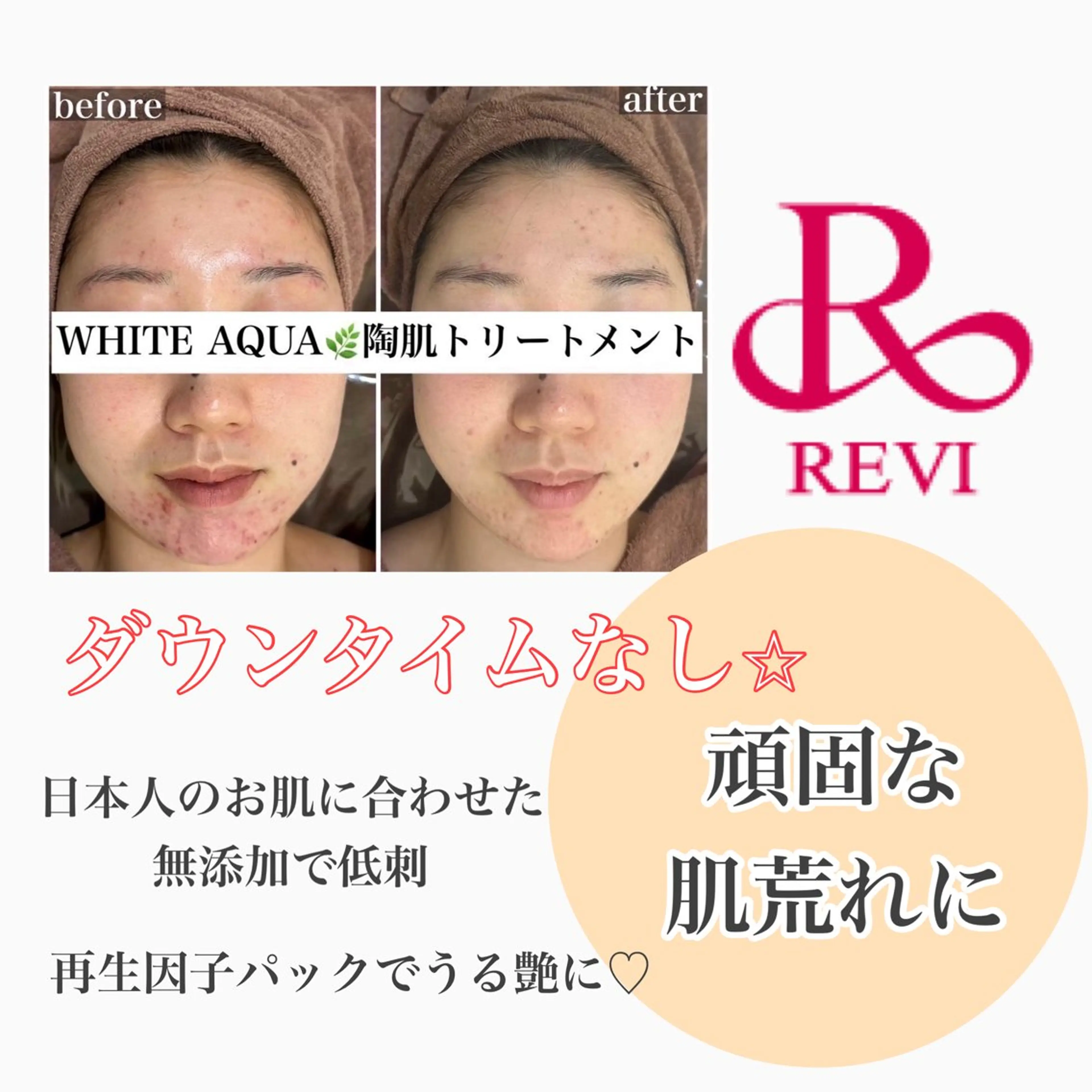 White Aqua 福岡博多店のエステ・リラクイメージ