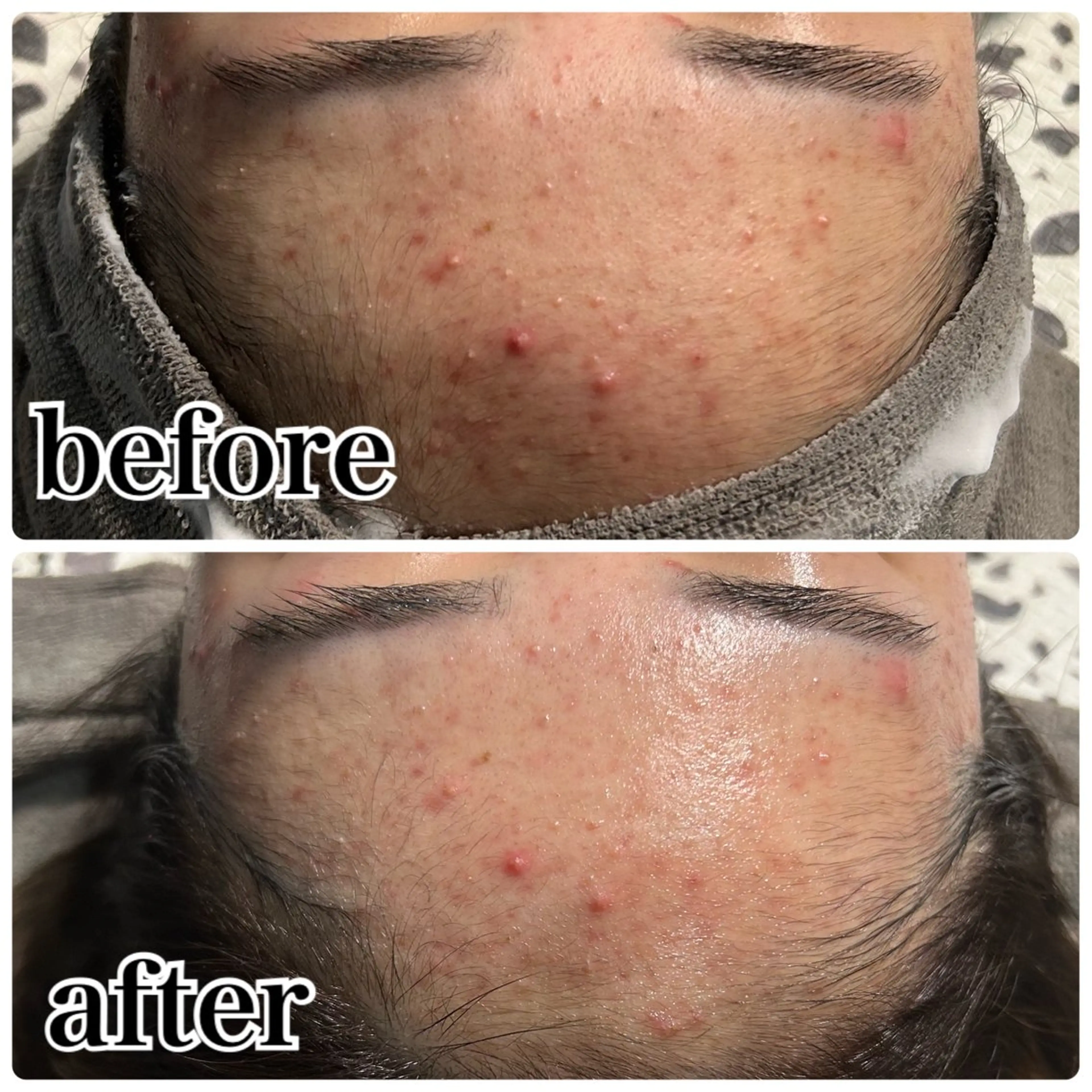 エステ Gemini 　MIKIのエステ・リラクイメージ