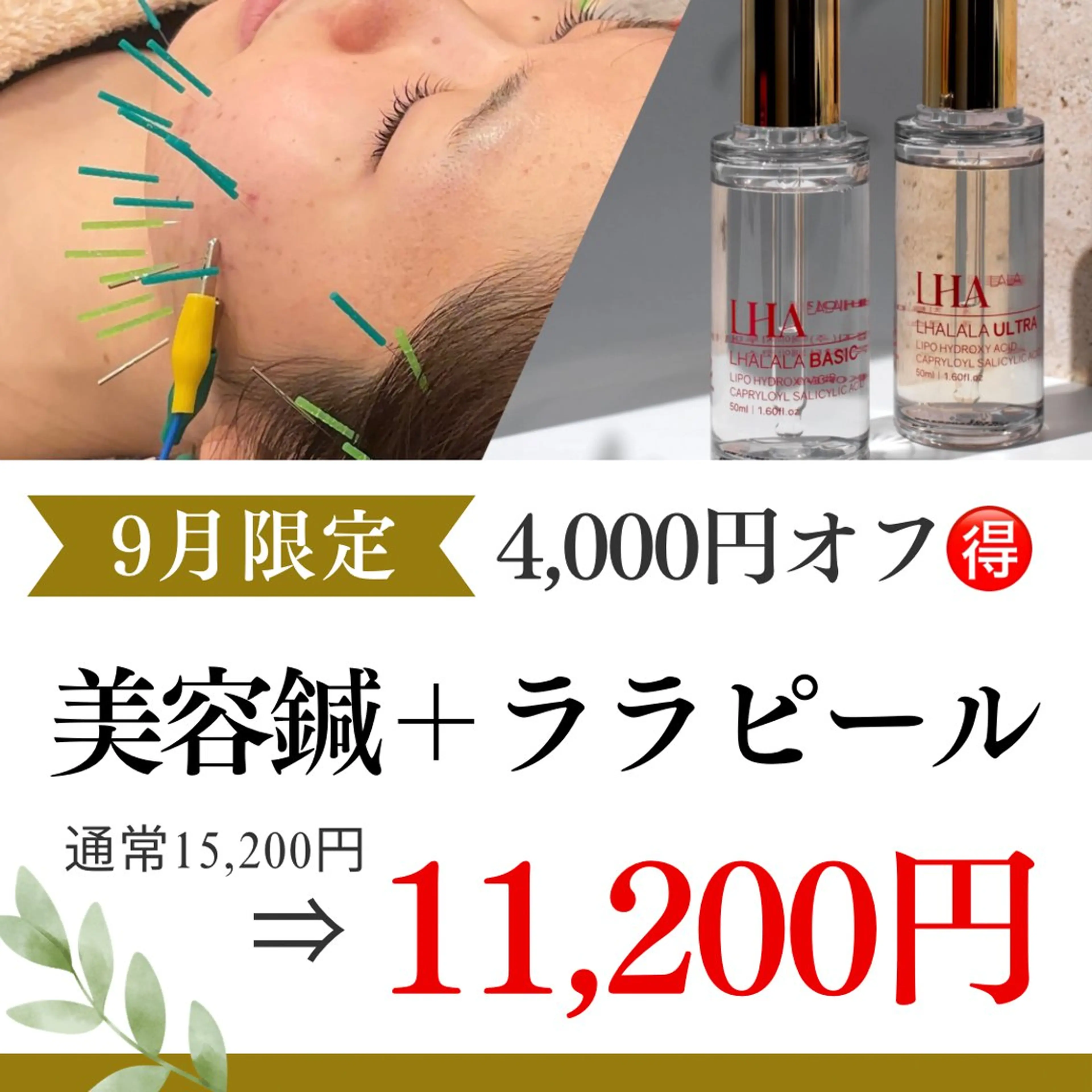【9月限定‼️】4,000円オフ🉐小顔美容鍼50本＋ララピール🇰🇷の写真