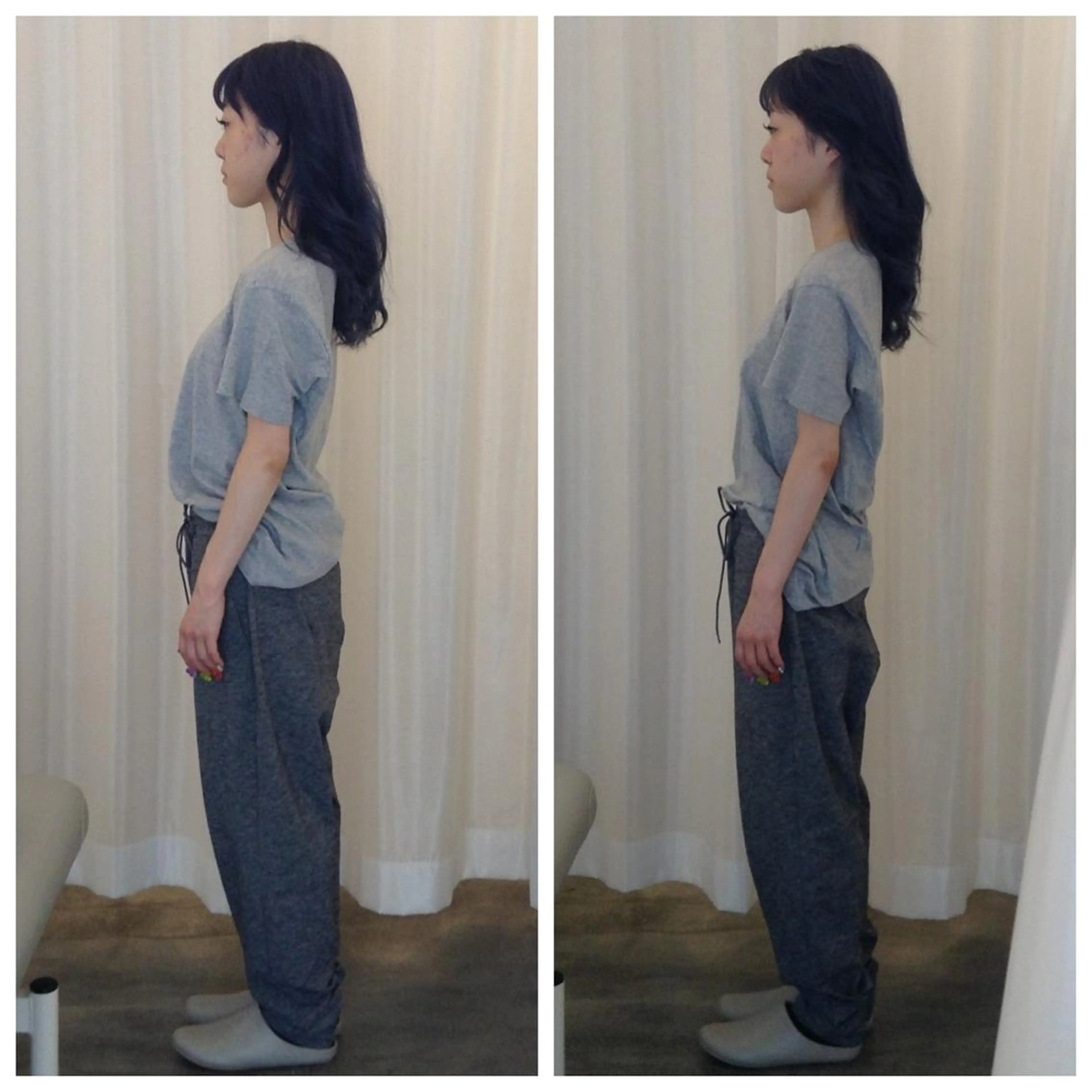 腰痛・肩こり＋顔の大きさ・エラ張り改善の写真