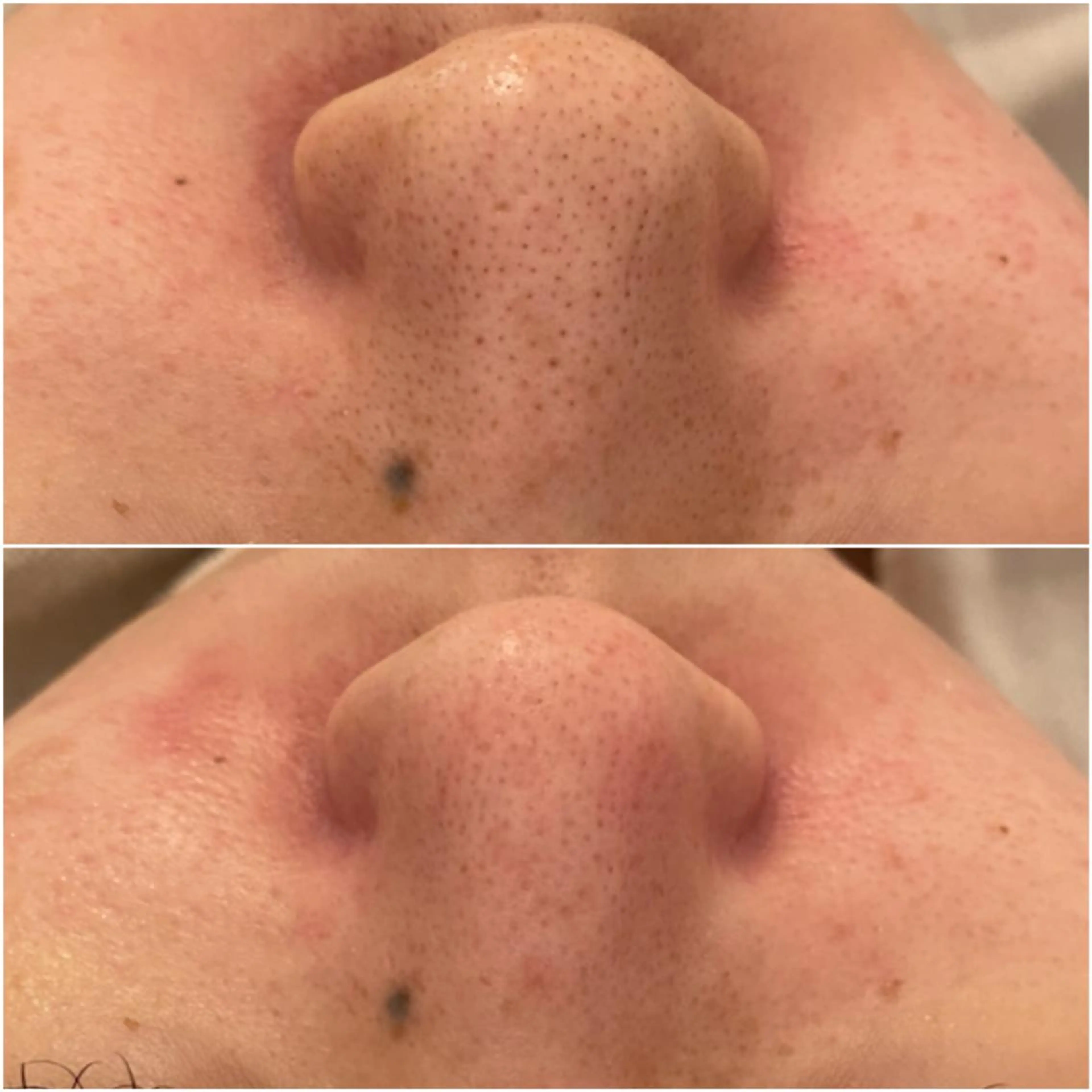 ✨美肌水光✨ アトリエリュバンのエステ・リラクイメージ