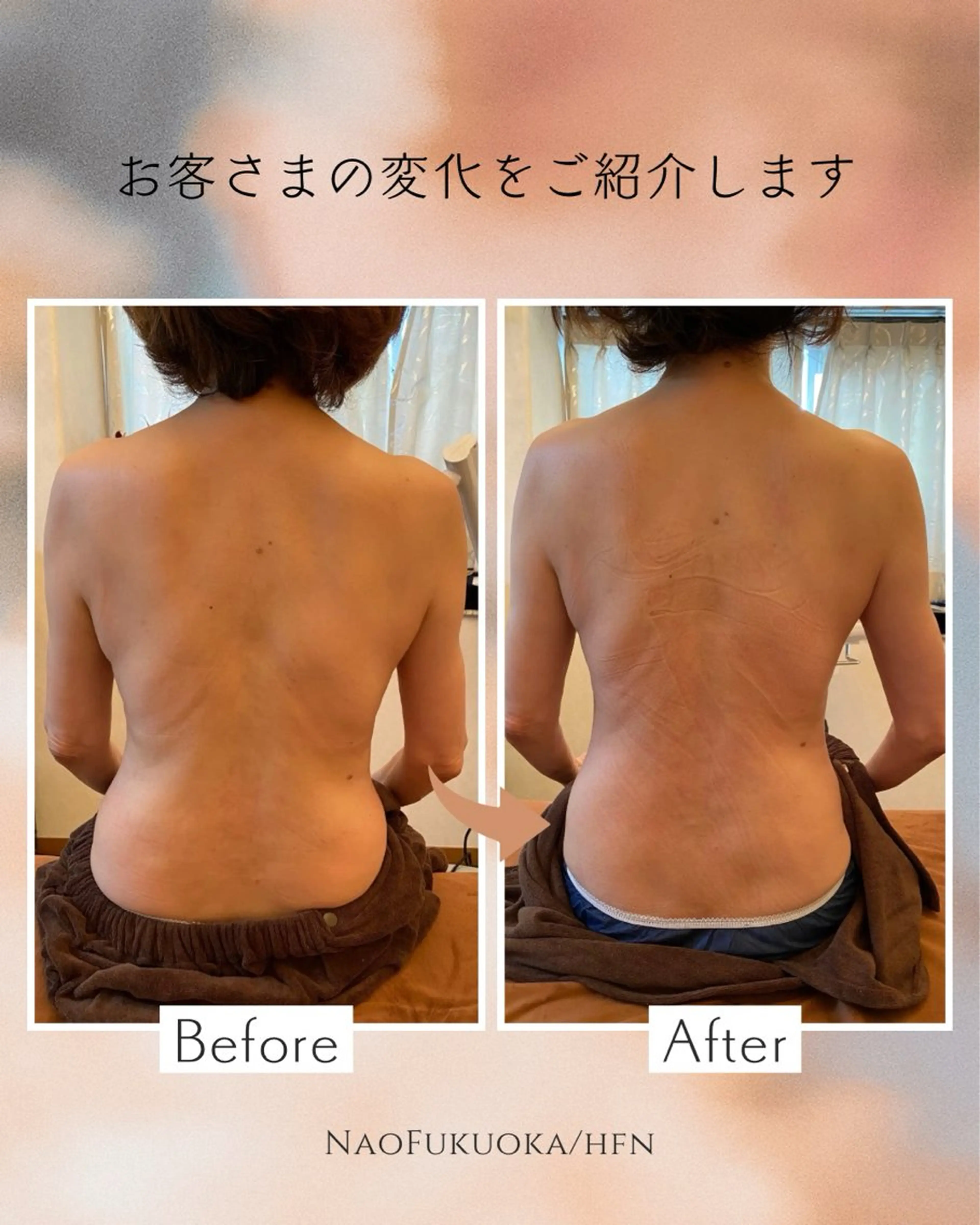 esther全身ケアトリートメント👐つま先から頭のてっぺんまで全身の老廃物をケア🩷痛み有🈶の写真