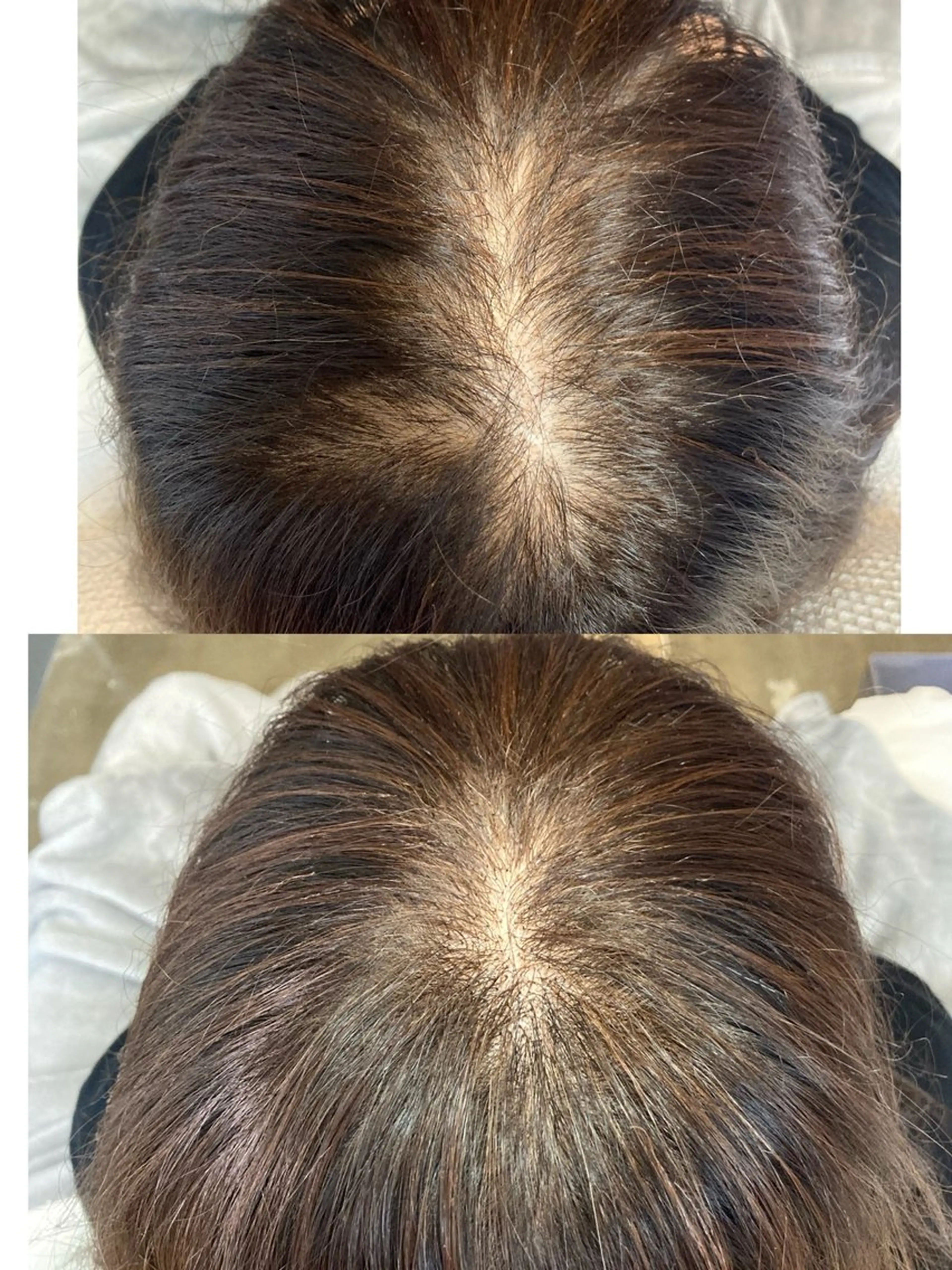 エクステ 25ニコ所属・25 ニコのヘアスタイル