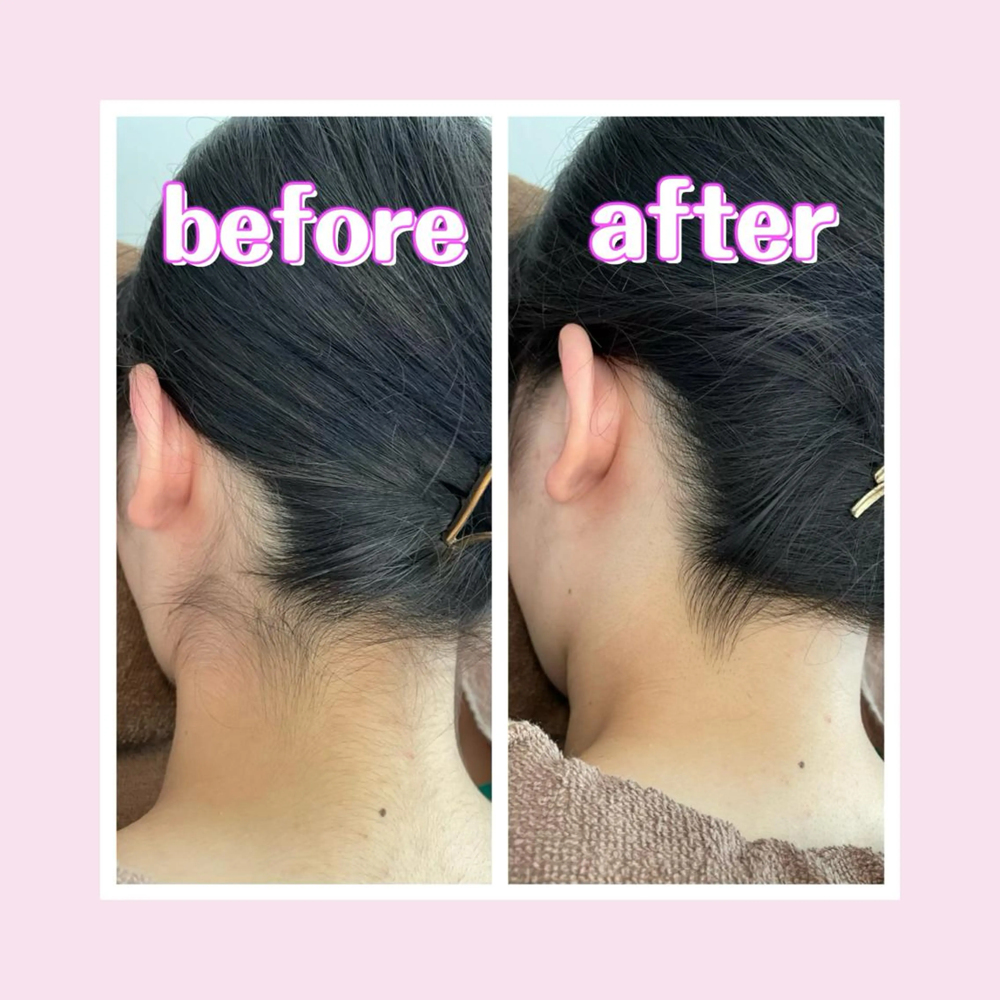 脱毛 salonde ReGodのエステ・リラクイメージ